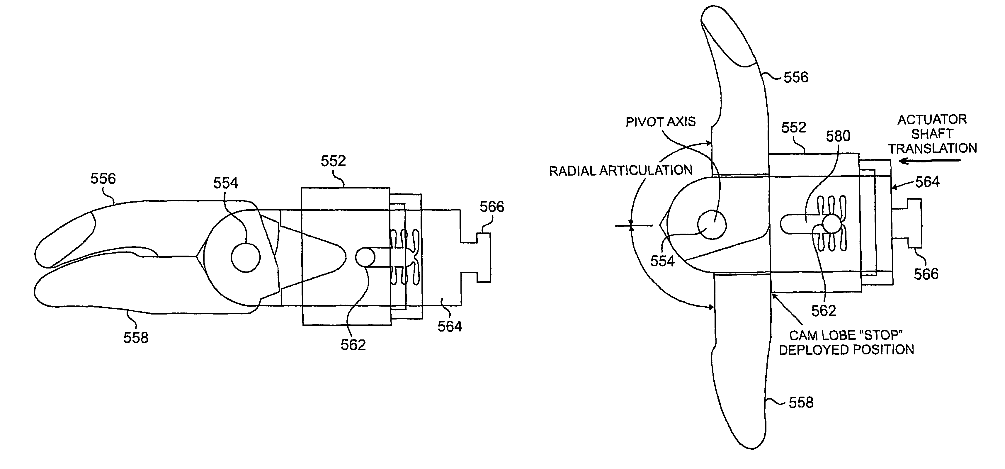 Systems and methods for posterior dynamic stabilization of the spine