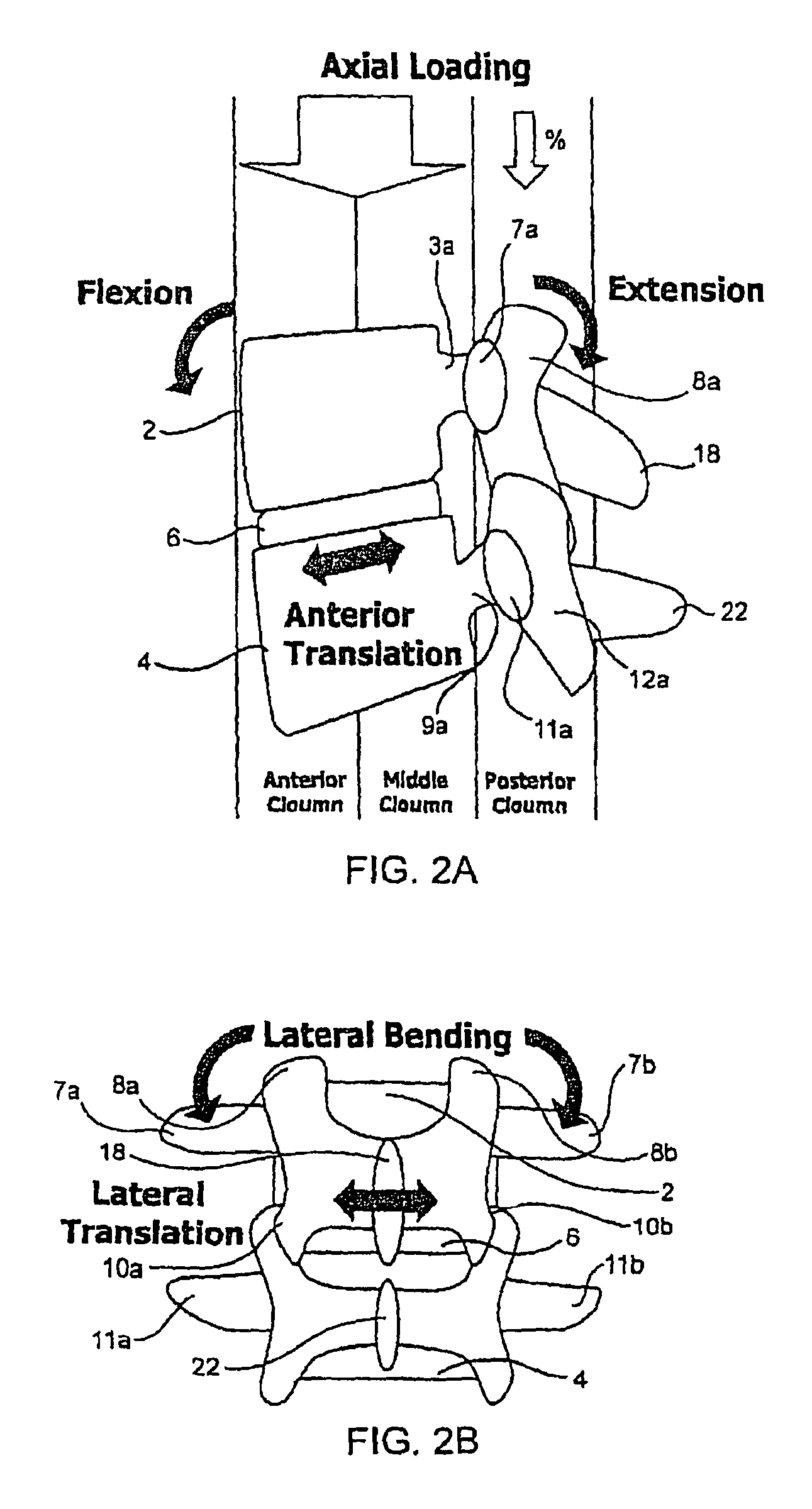 Systems and methods for posterior dynamic stabilization of the spine