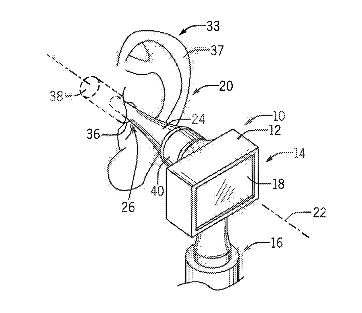 Otoscope Providing Low Obstruction Electronic Display