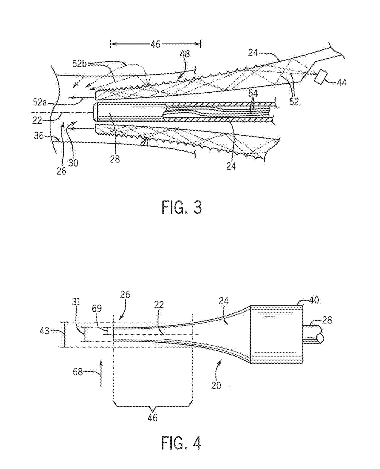 Otoscope Providing Low Obstruction Electronic Display