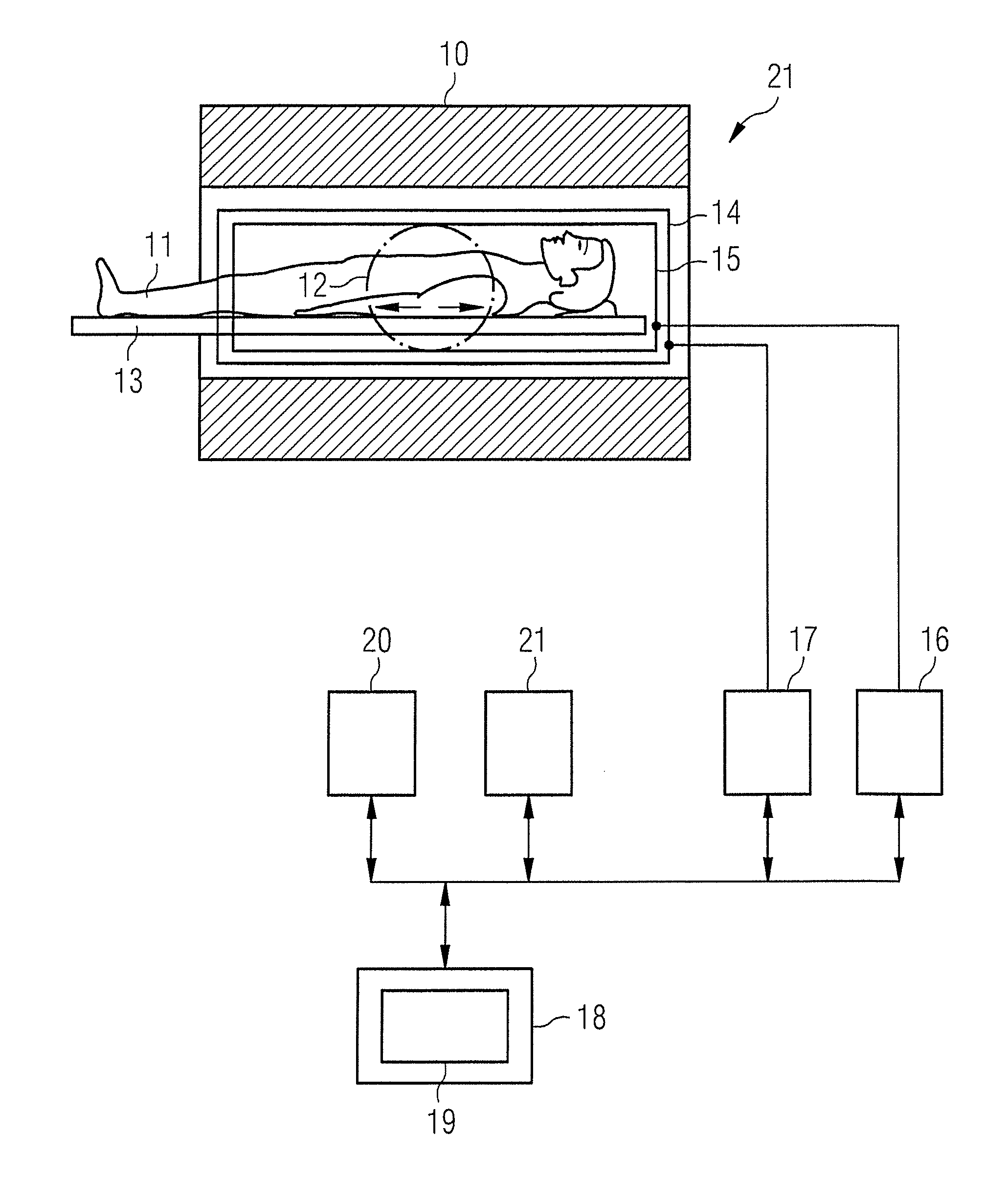 Magnetic resonance method and apparatus to reduce artifacts in diffusion-weighted imaging