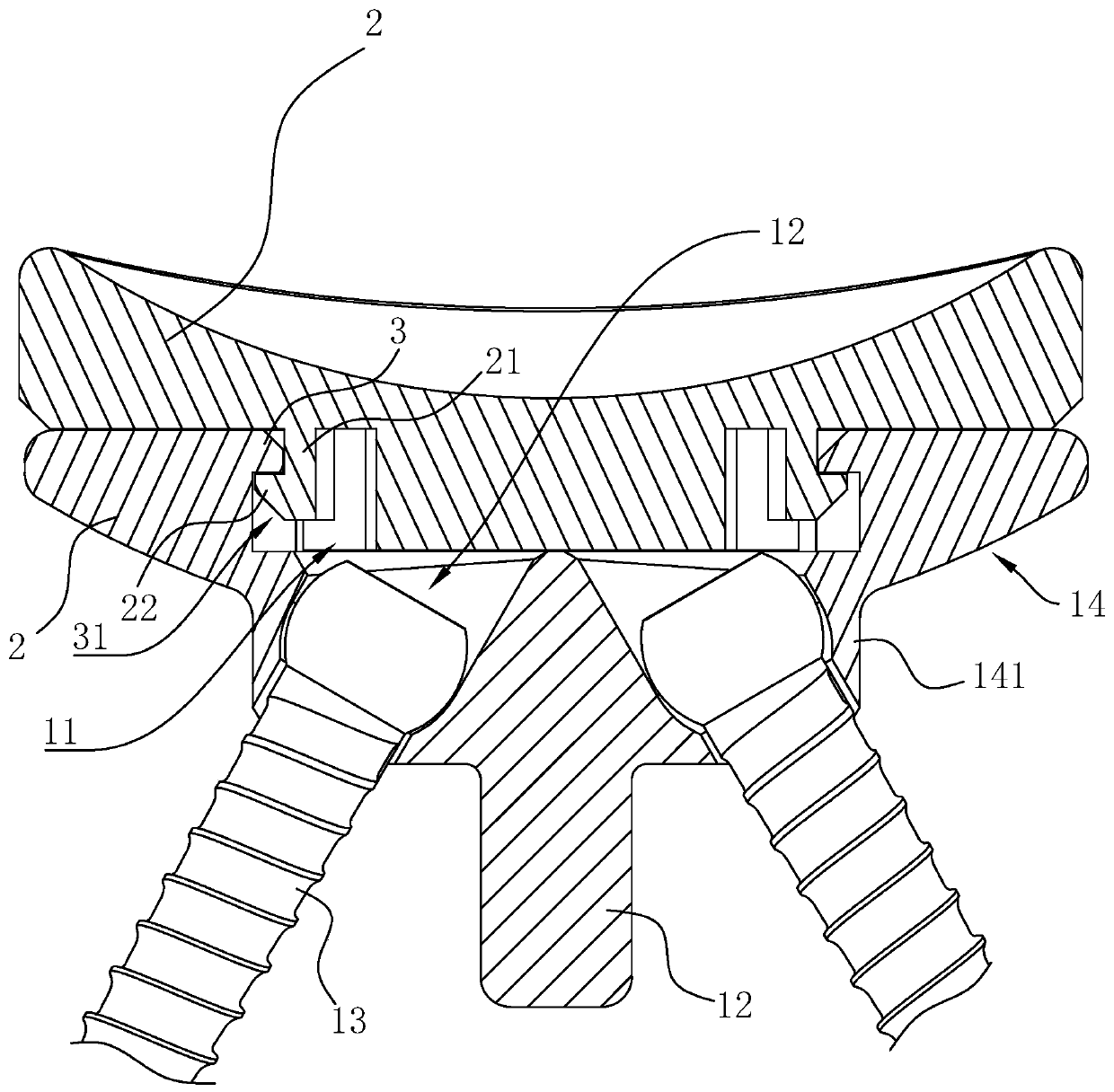 Glenoid prosthesis applied to total shoulder joint replacement