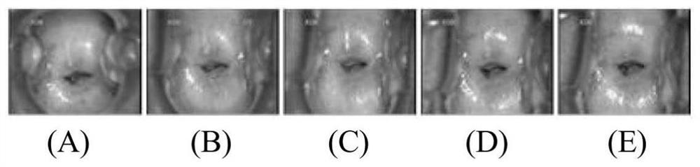 Image feature fusion method, device and medium