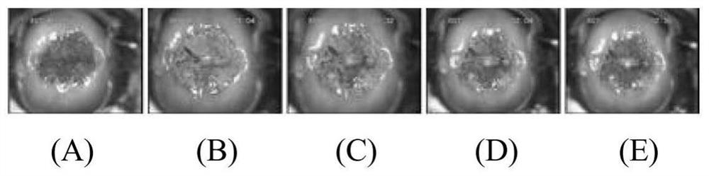 Image feature fusion method, device and medium