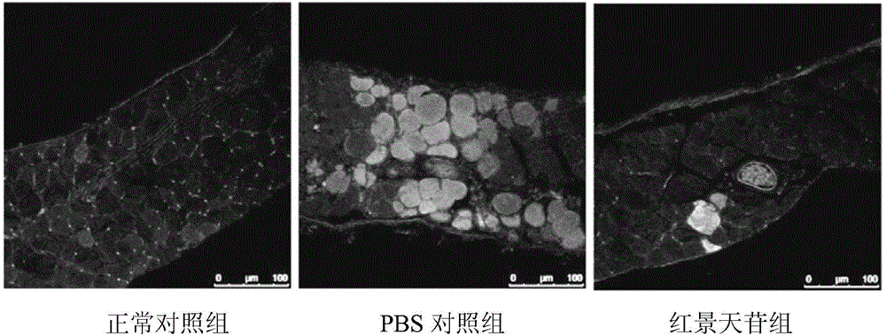 Application of salidroside in preparing medicine for treating duchenne muscular dystrophy