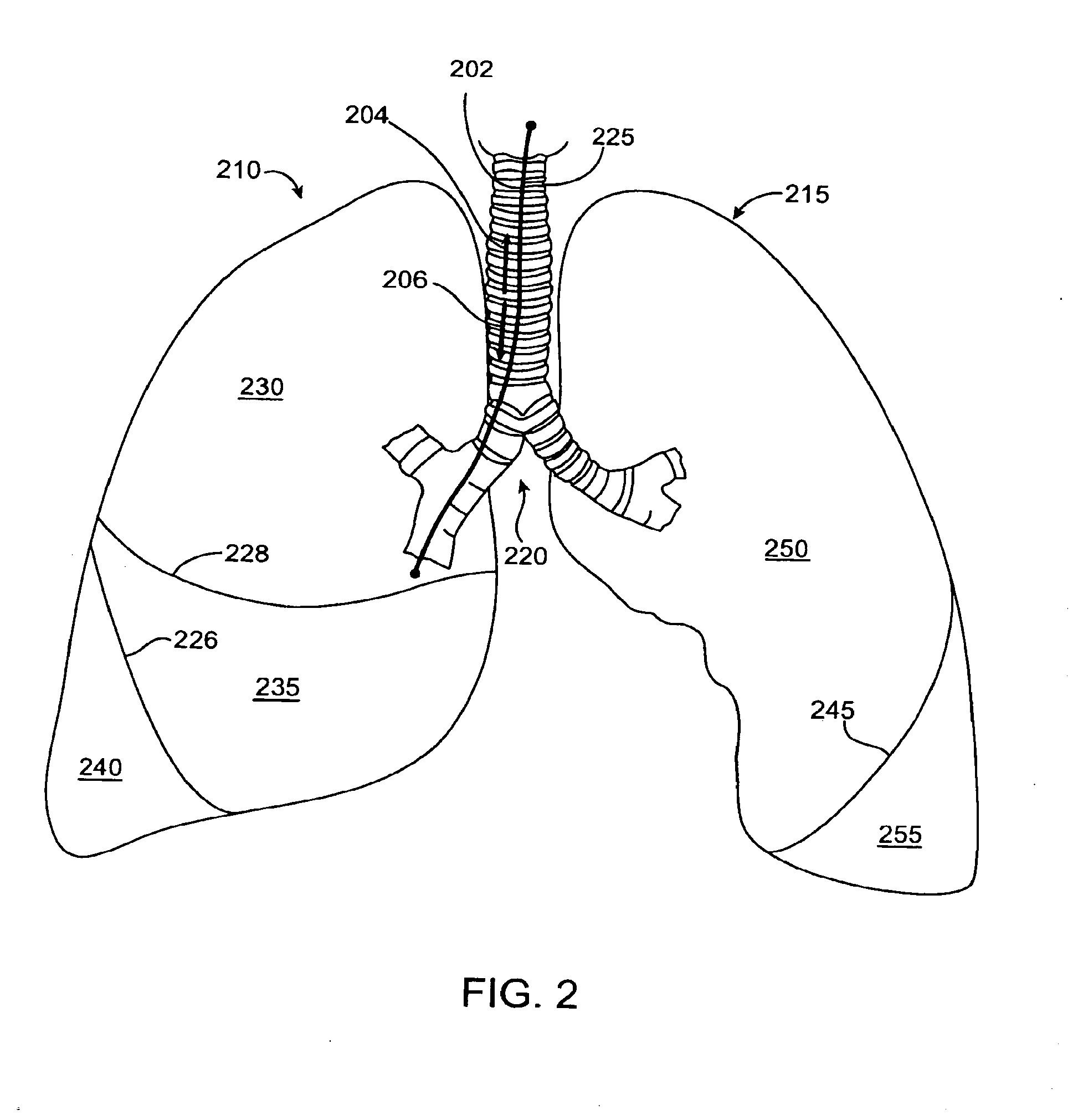 Bronchial flow control devices and methods of use