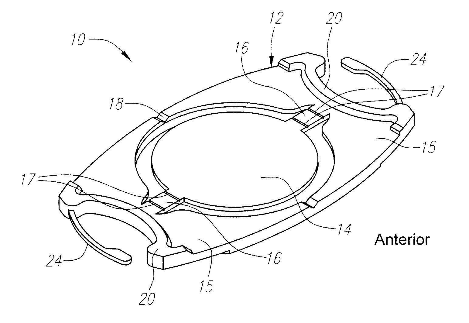 "w" accommodating intraocular lens