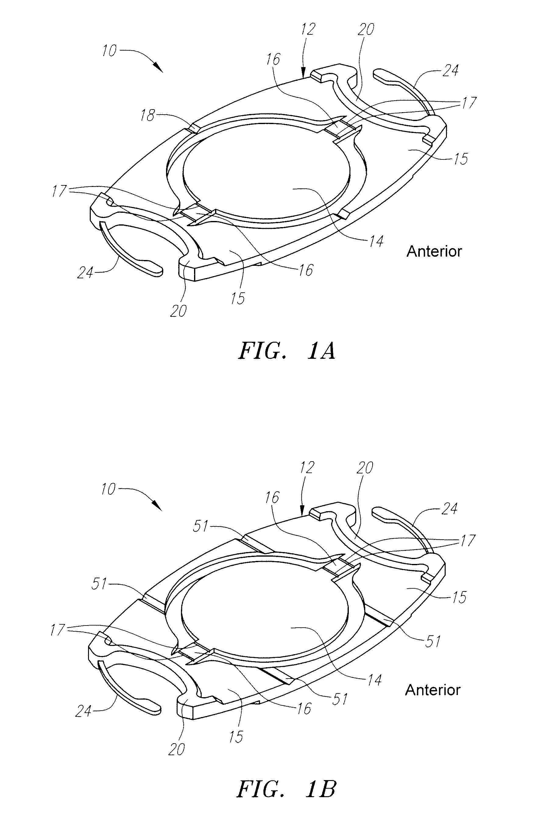 "w" accommodating intraocular lens