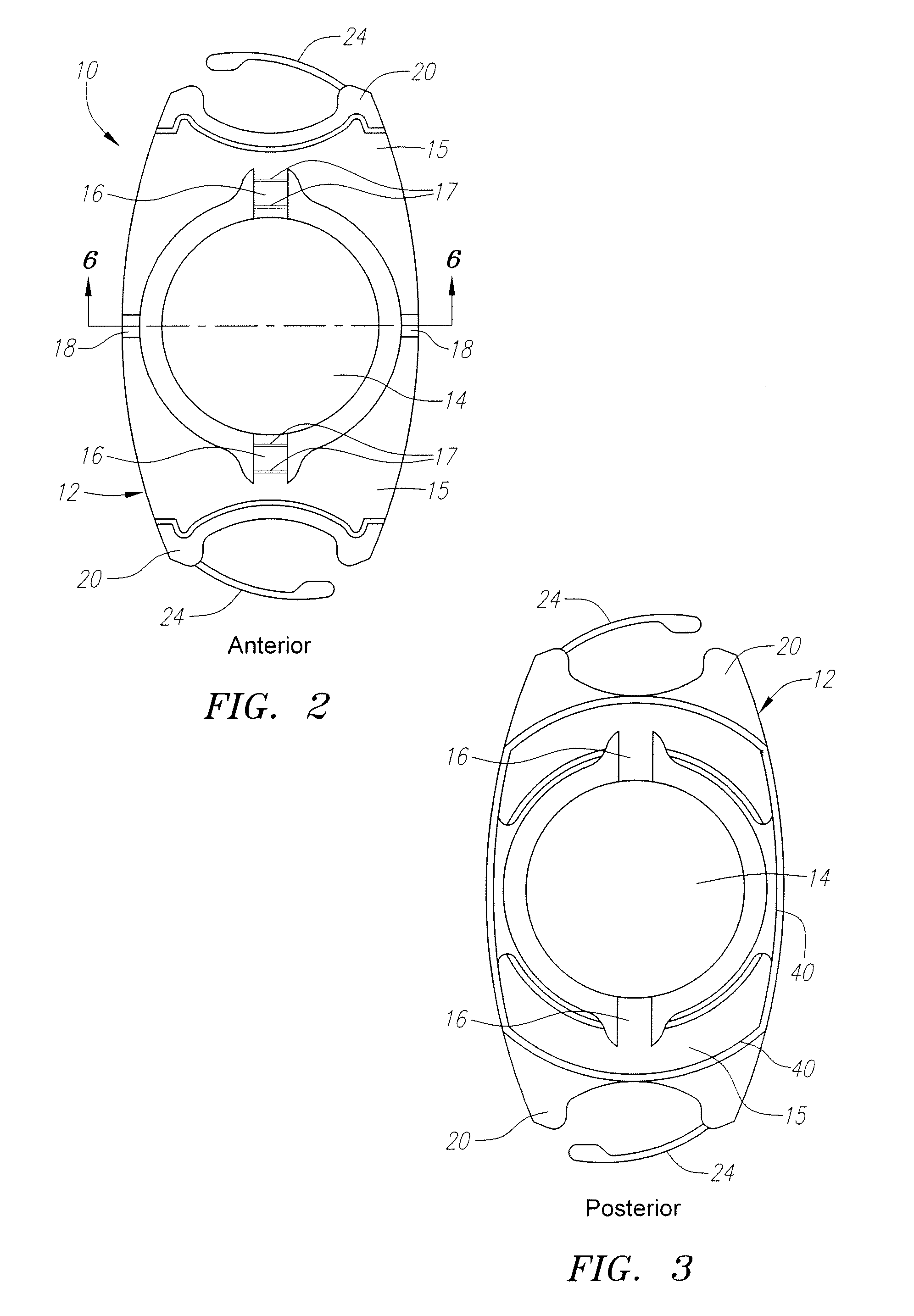 "w" accommodating intraocular lens