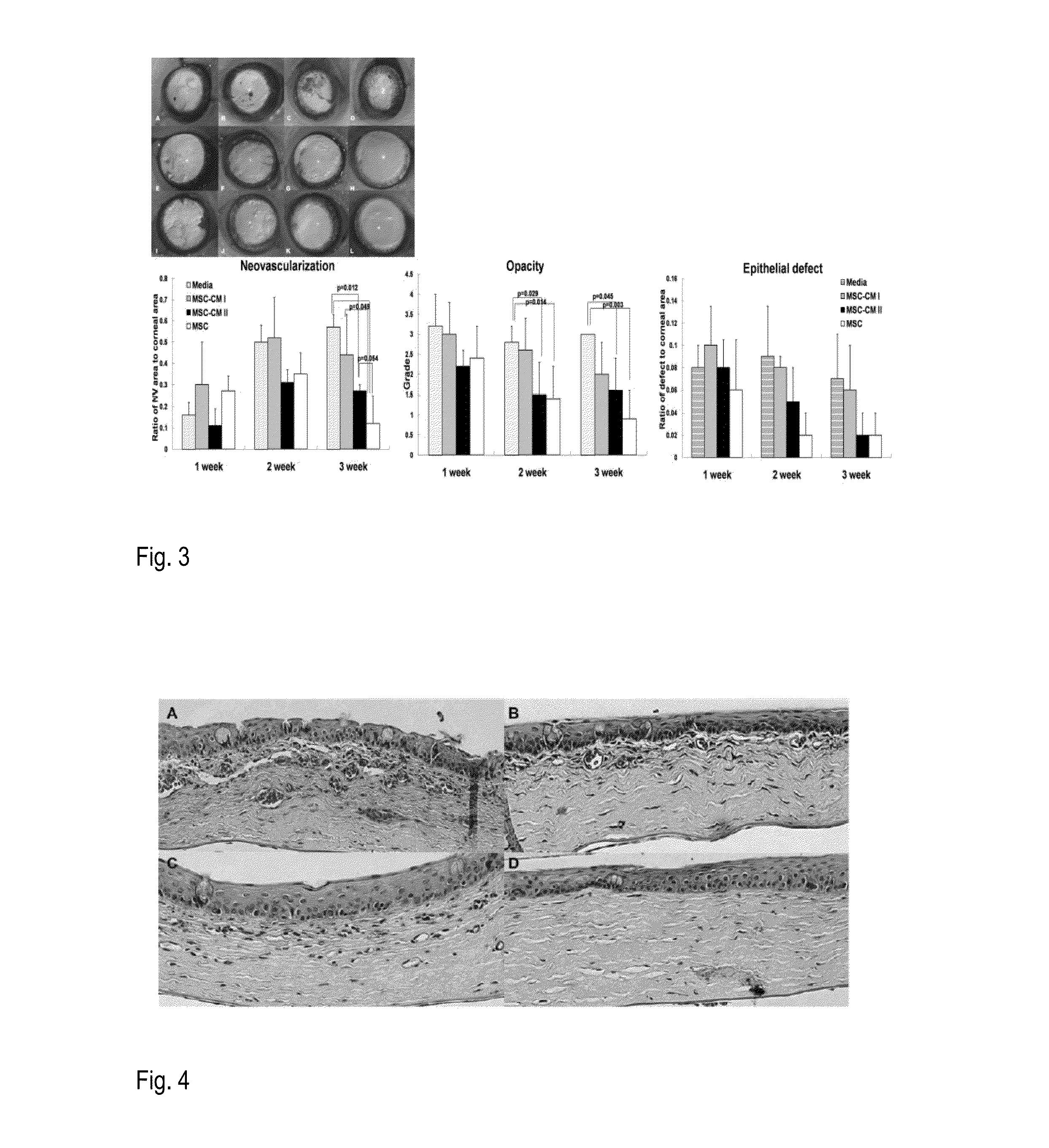 Protein Therapy for Treatment of Eye Diseases