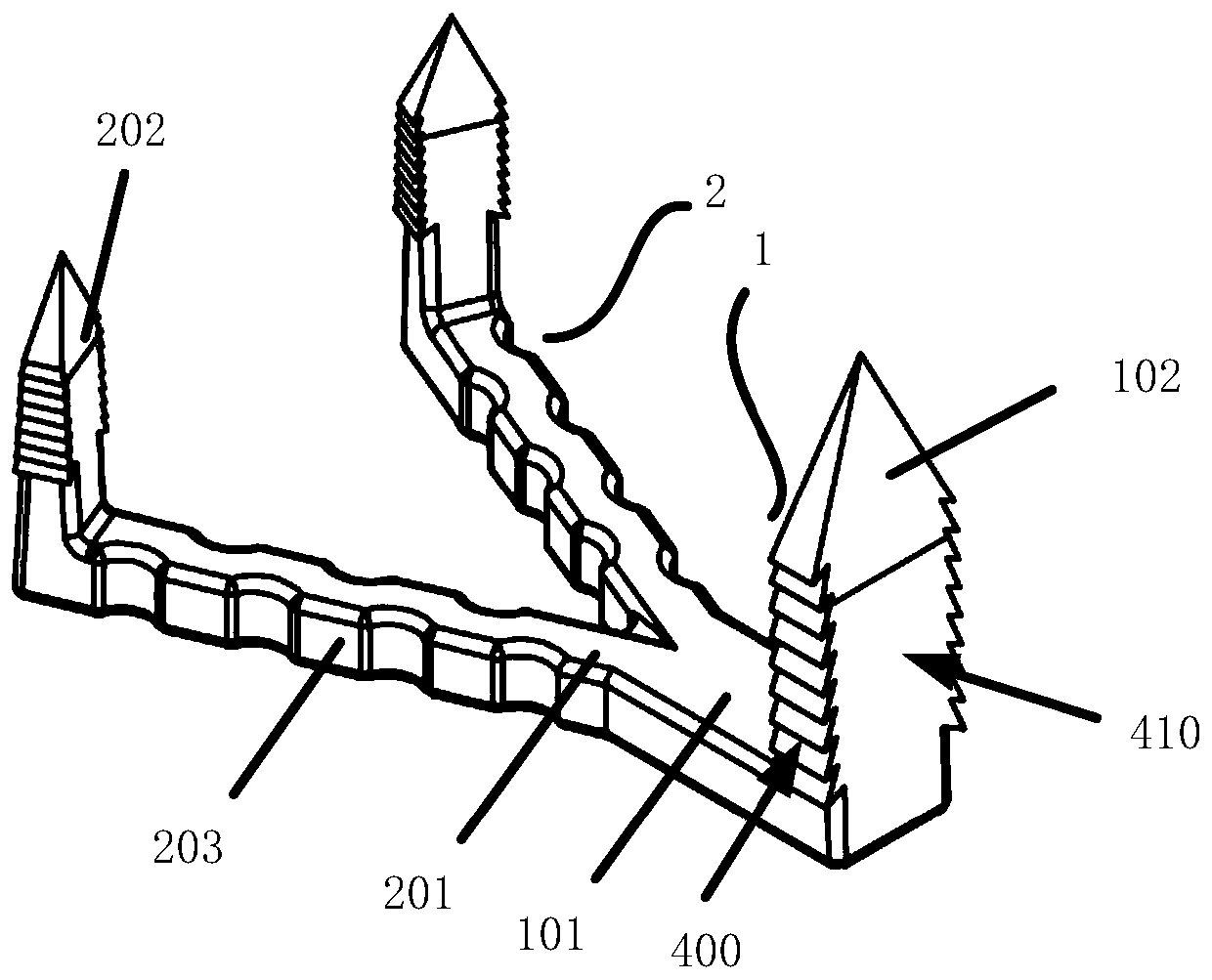 Compression Screw Plate System