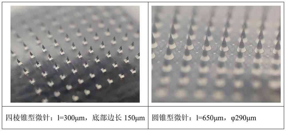 Biological soluble microneedle patch and preparation method thereof