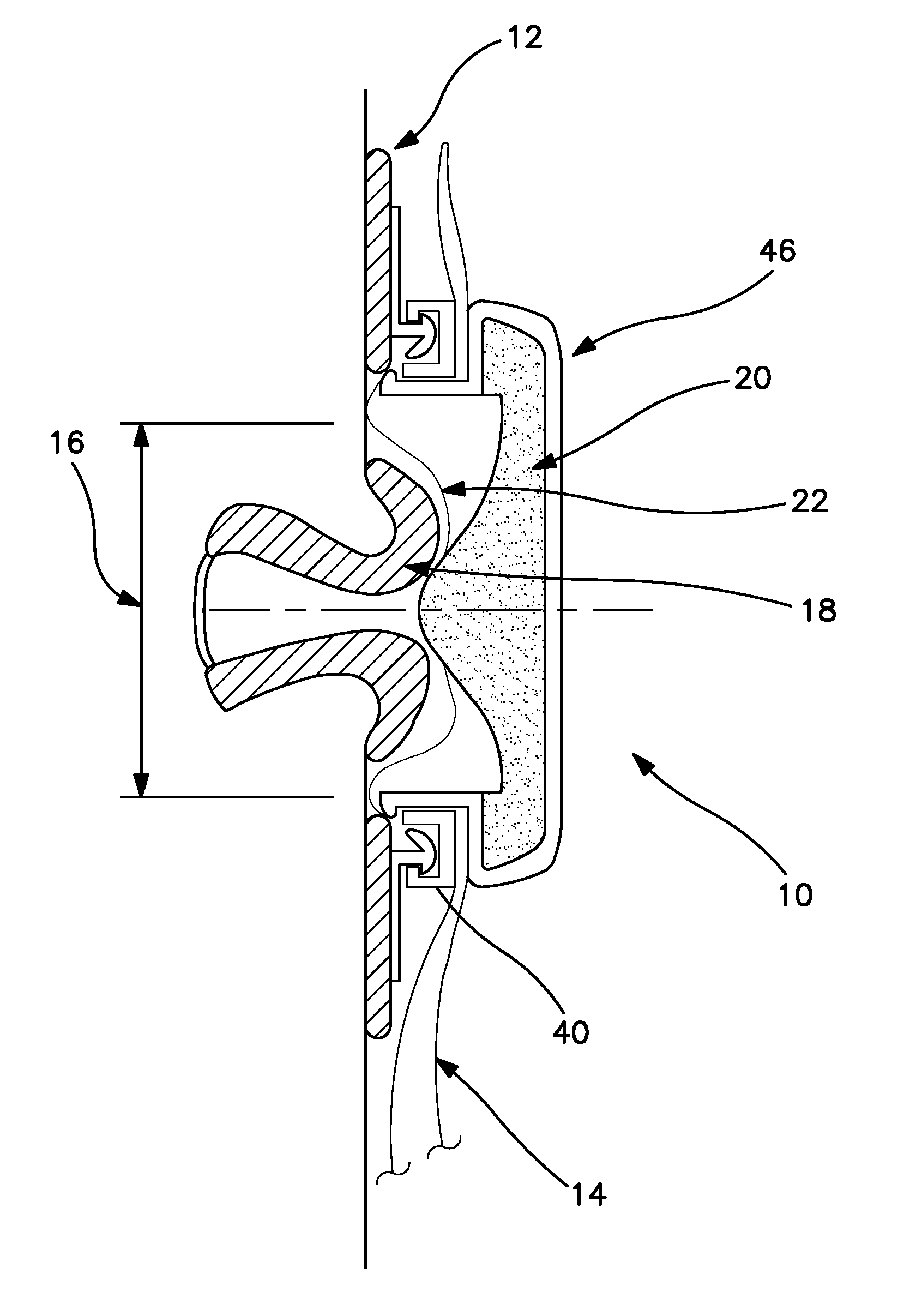 Controlled evacuation ostomy appliance