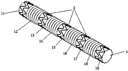 Covered stent used in chest great vessel cavity