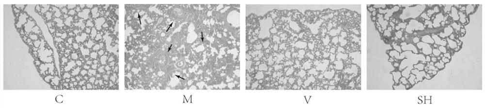 Application of mogroside V and biomarker of mogroside V acting on lung inflammation