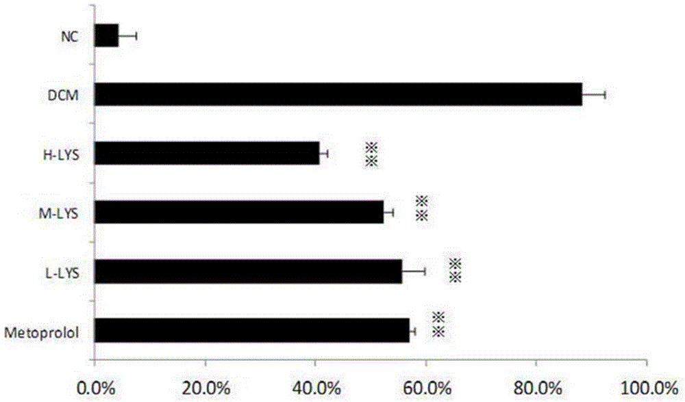 Application of chlorogenic acid in preparation of medicines for treating cardiomyopathy