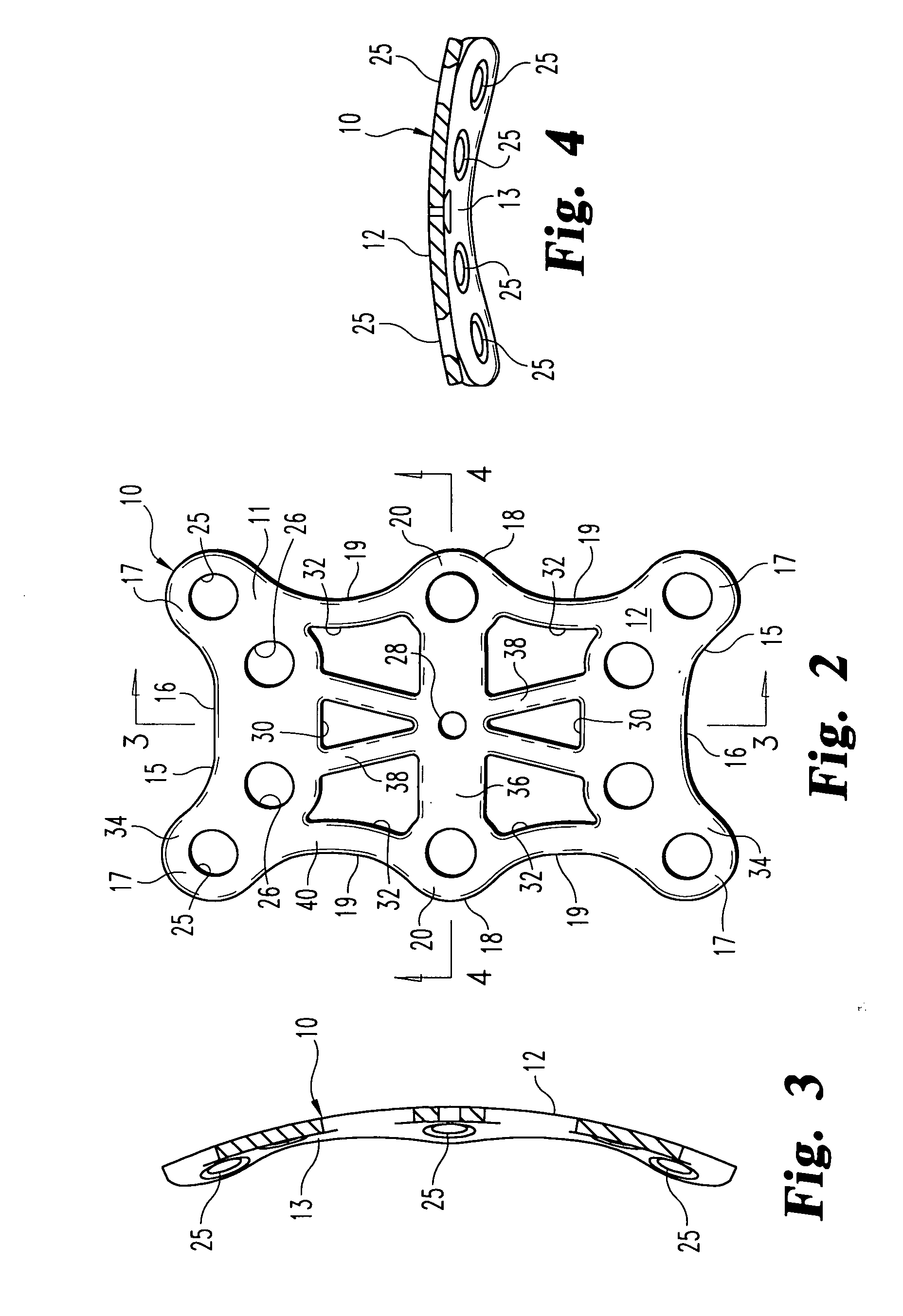 Mid-foot fixation plate