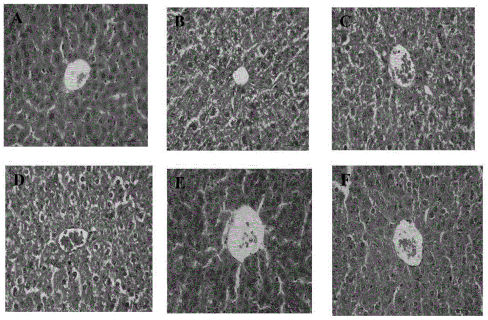 Application of matteuccia struthiopteris total triterpenes to protection of chronic alcoholic liver damage