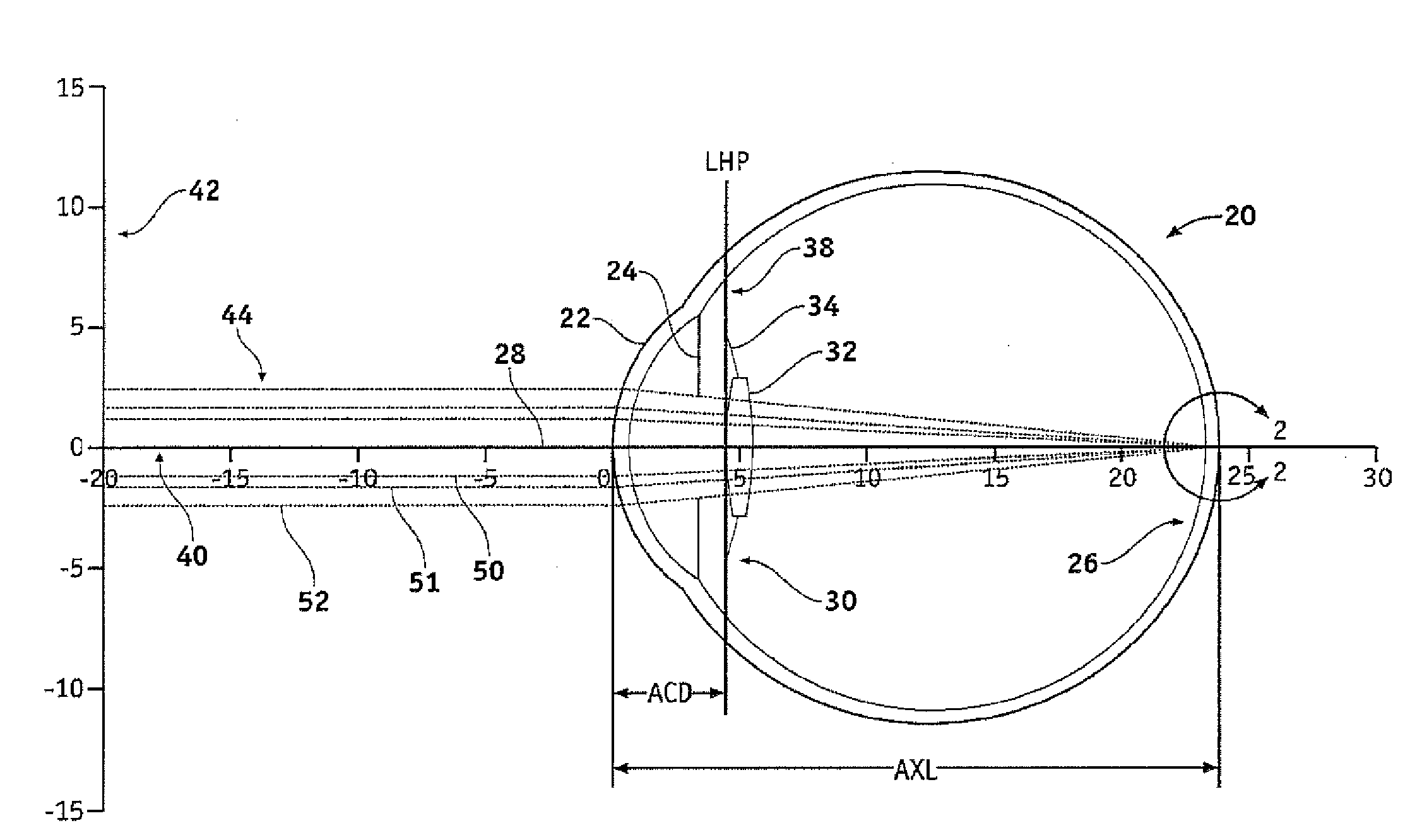 Apparatus, system, and method for intraocular lens power calculation using a regression formula incorporating corneal spherical aberration