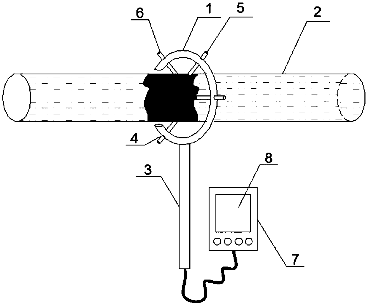 Portable detection device for blockage of exposed filling pipeline, and dredging method