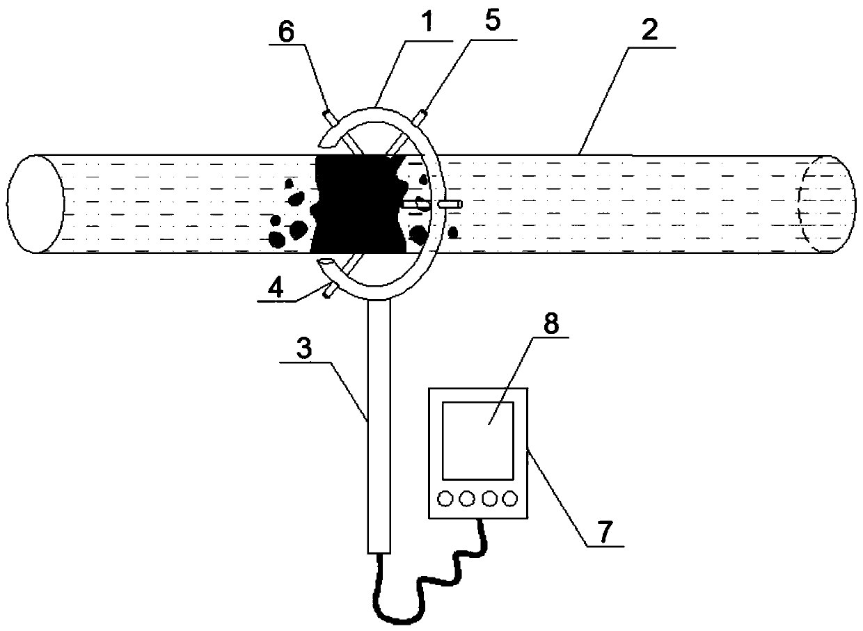 Portable detection device for blockage of exposed filling pipeline, and dredging method