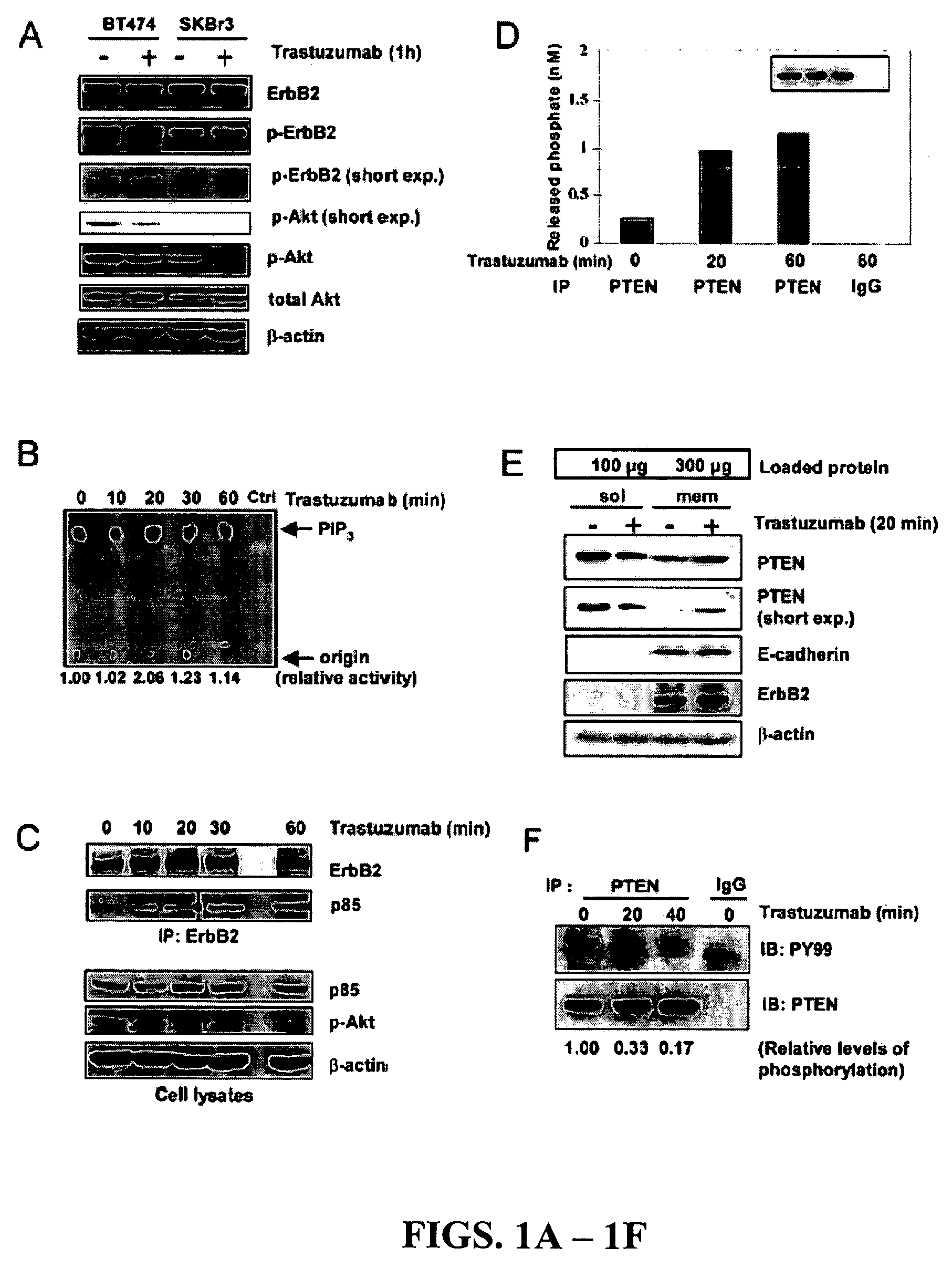 Diagnostic and therapeutic methods and compositions involving PTEN and breast cancer