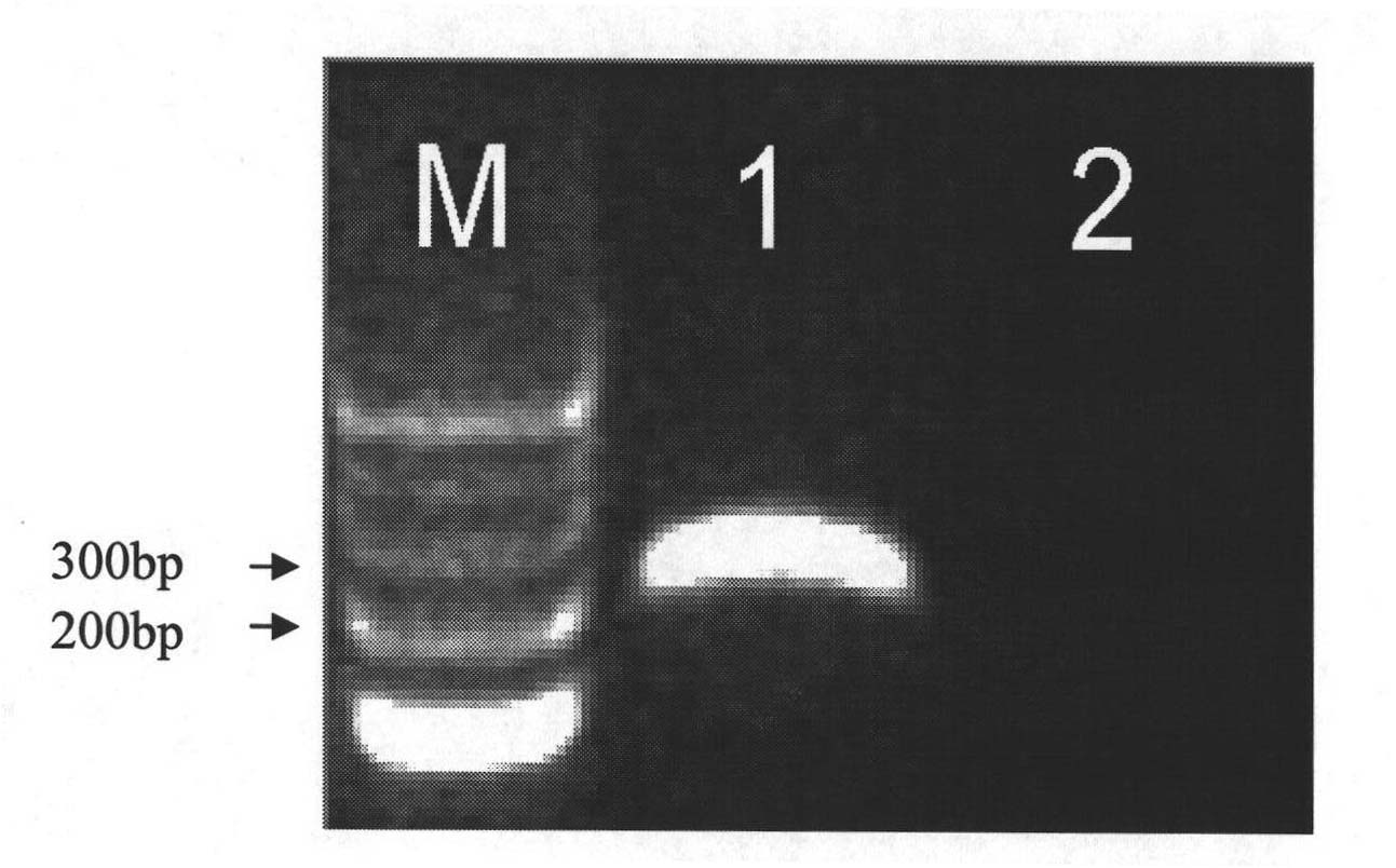 Nosema bombycis SYBT Green fluorescence quantitative PCR (Polymerase Chain Reaction) detection method as well as kit and specific primer thereof