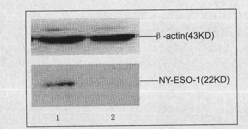 Plasmid for silencing cytokine signal inhibitory factor 1 and expressing high mobility group B1 protein and tumor associated antigen and preparation method thereof