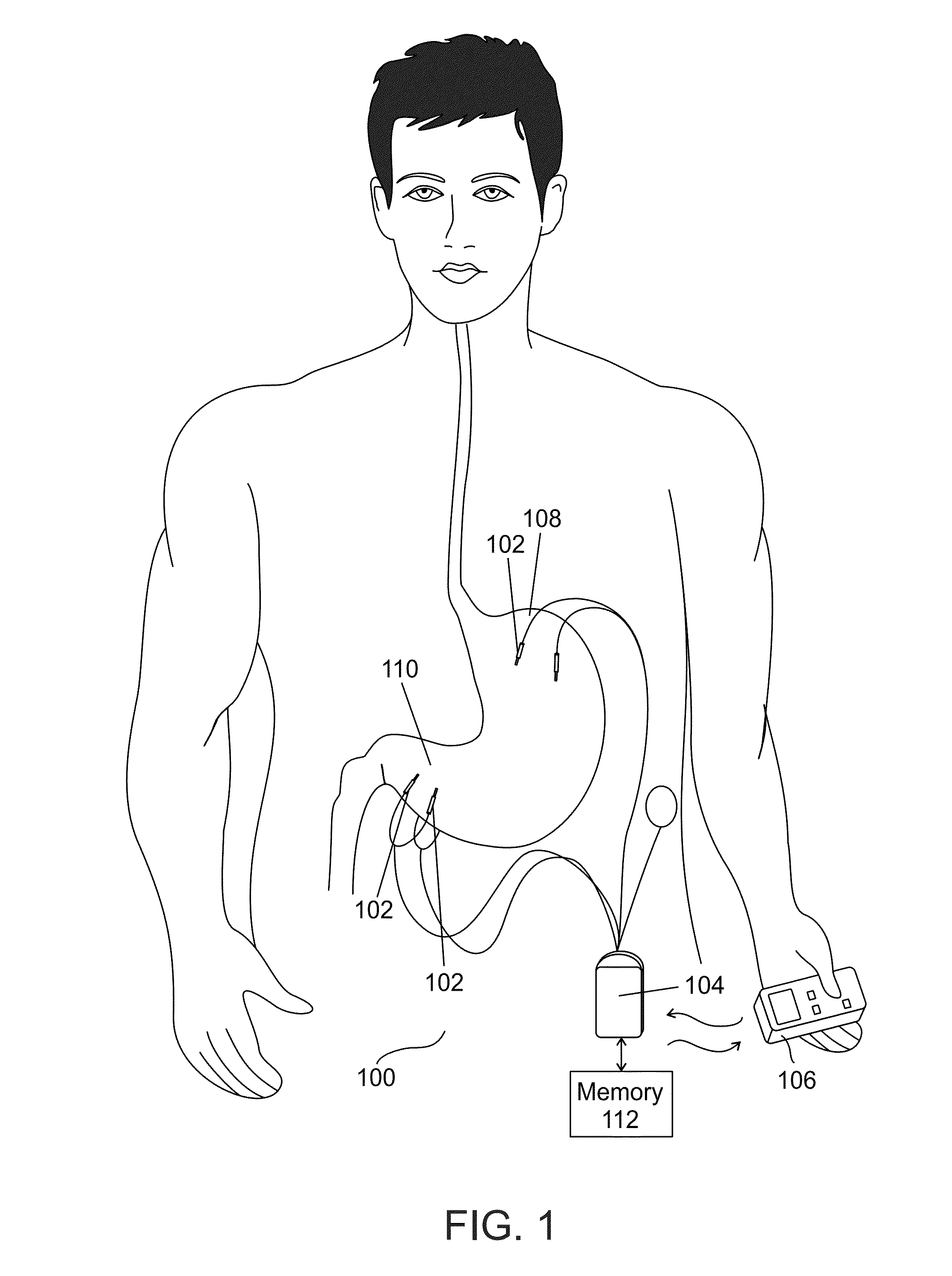 Method of treating a patient