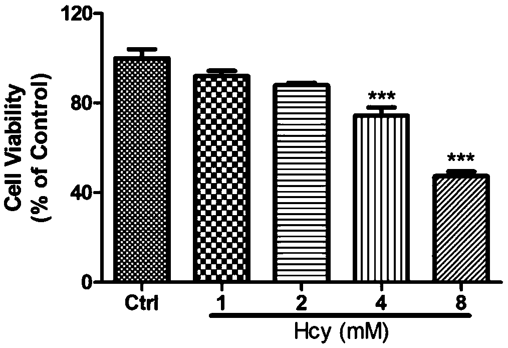 Application of sodium tanshinone IIA sulfonate in preparation of medicines for treating acute or chronic diseases accompanied with increase of homocysteine in blood