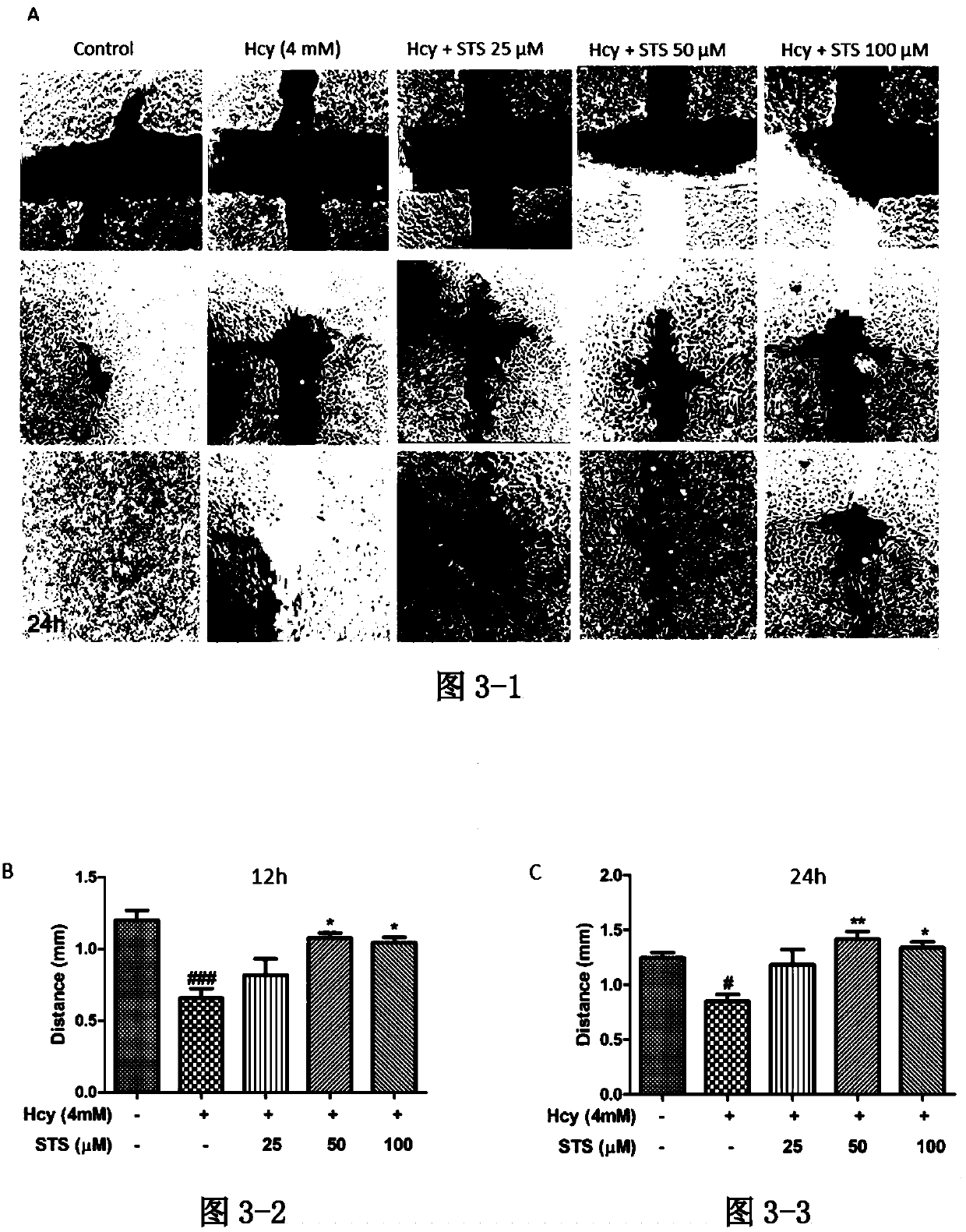 Application of sodium tanshinone IIA sulfonate in preparation of medicines for treating acute or chronic diseases accompanied with increase of homocysteine in blood