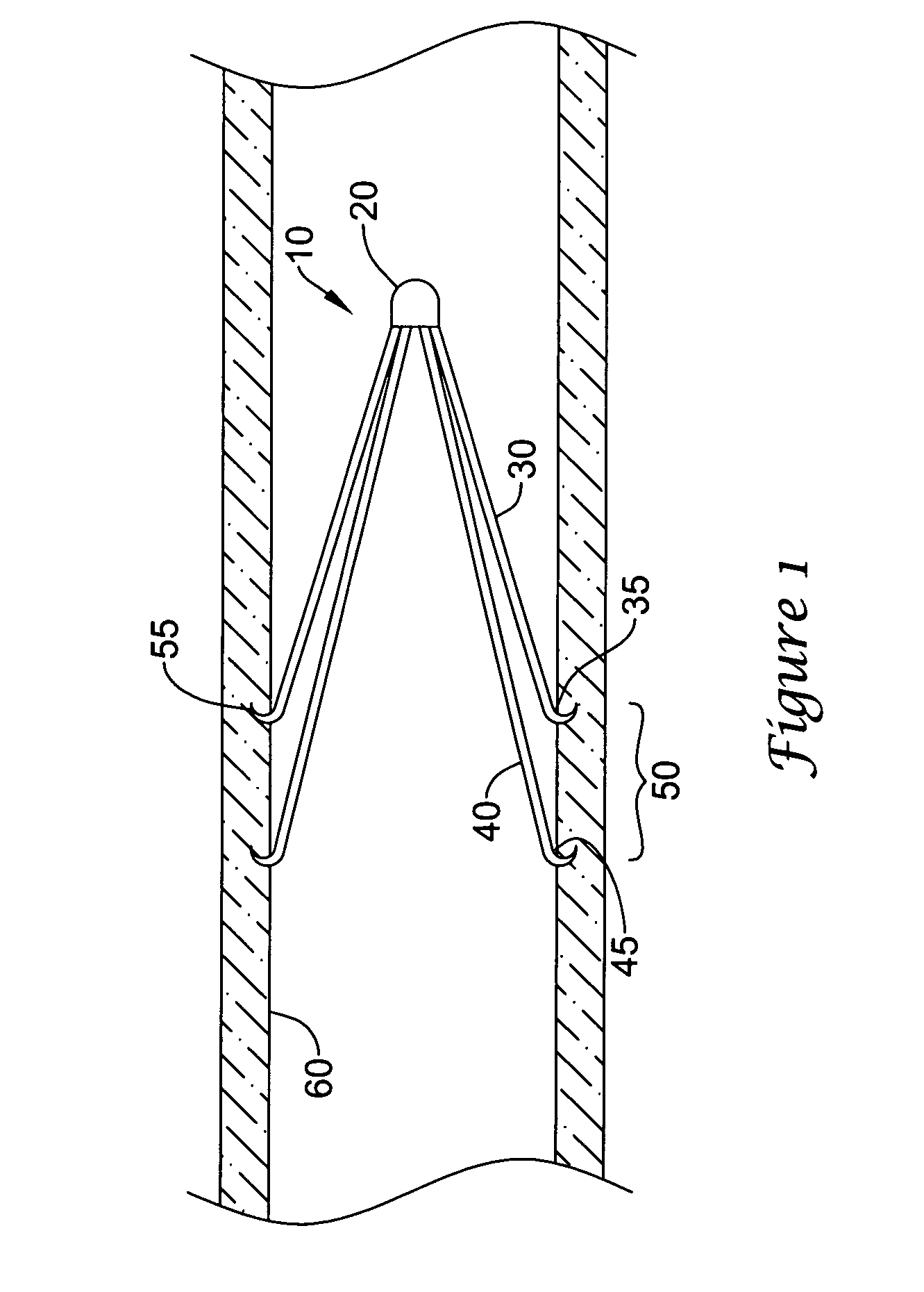 Filter with positioning and retrieval devices and methods