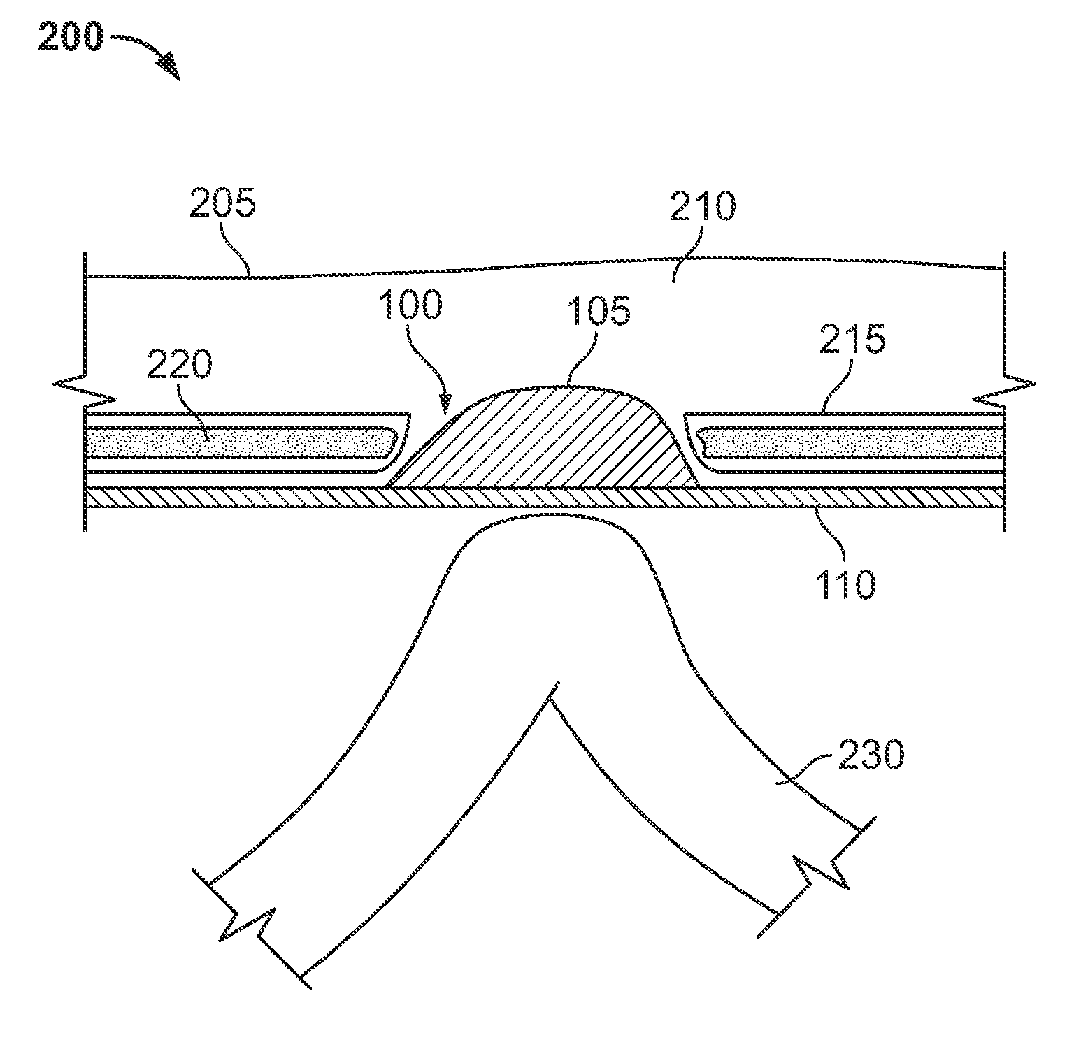 Hernia mesh apparatus and method