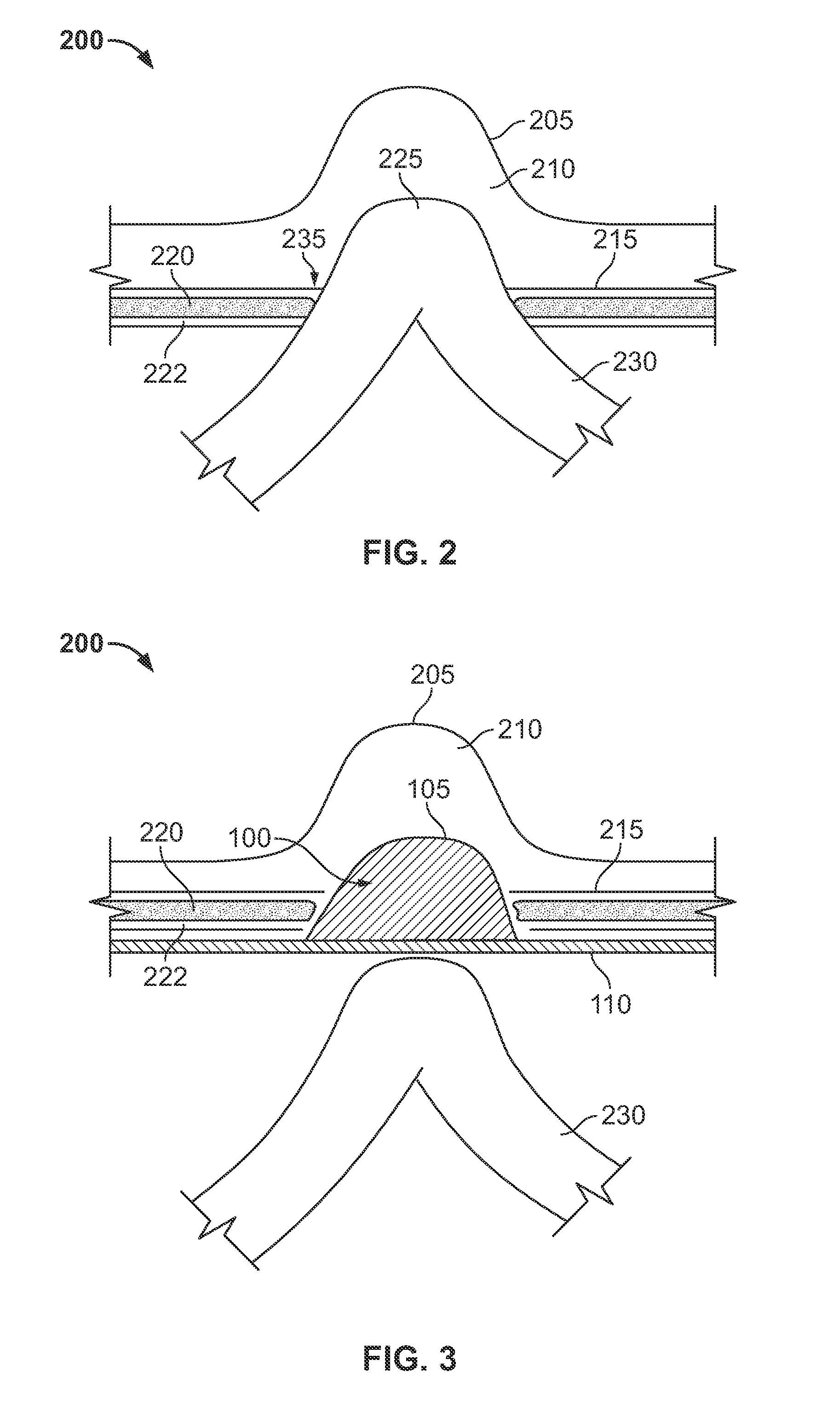 Hernia mesh apparatus and method