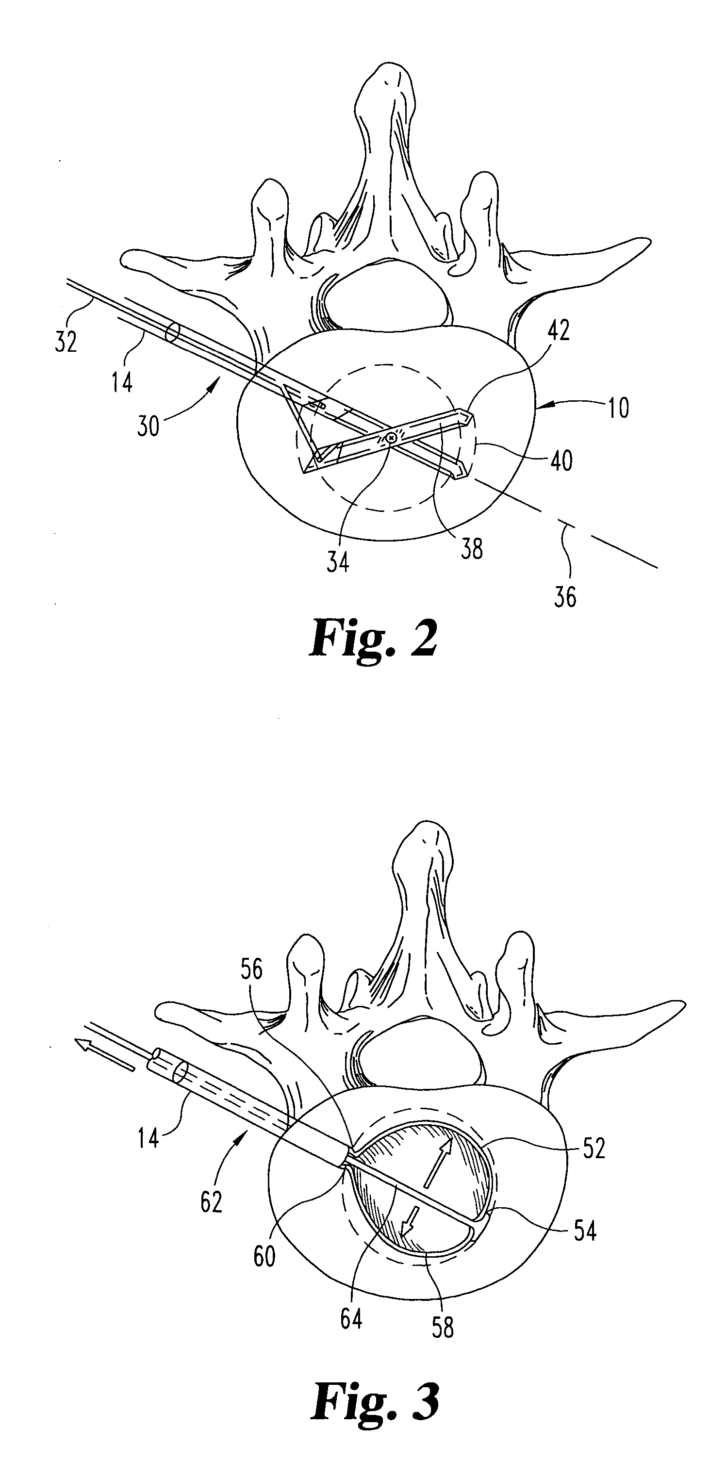 Transverse cavity device and method