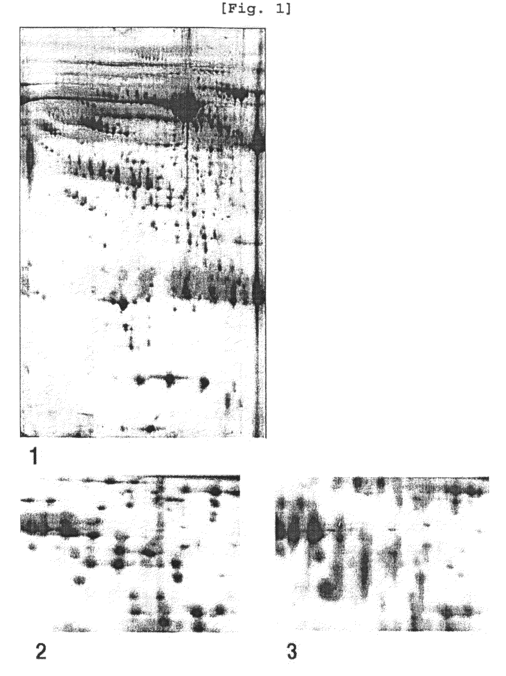 Protein markers for diagnosing stomach cancer and the diagnostic kit using them