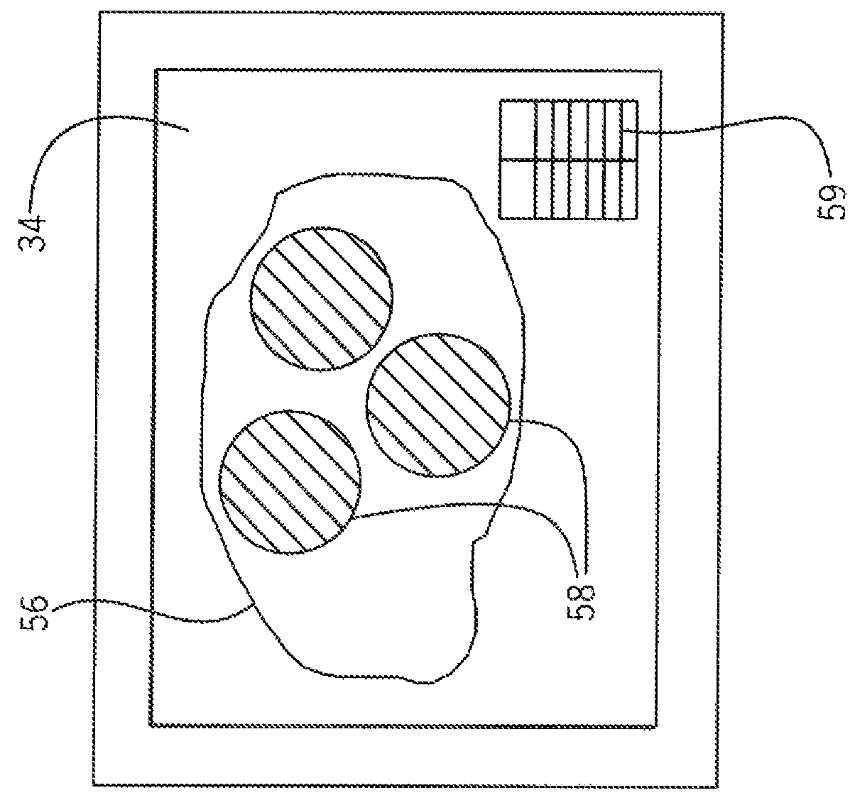 System for characterizing brain condition