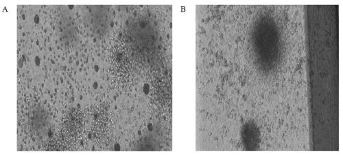 Method for extracting hematopoietic stem cells