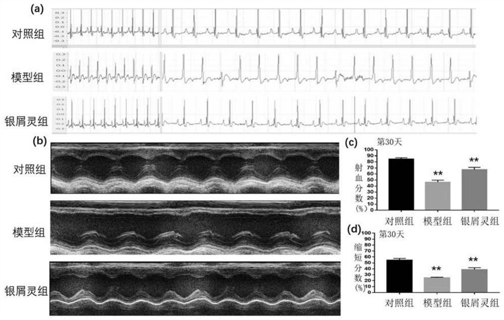 Application of traditional Chinese medicine for the treatment of psoriasis in the preparation of drugs for the prevention and treatment of myocardial ischemia-reperfusion injury