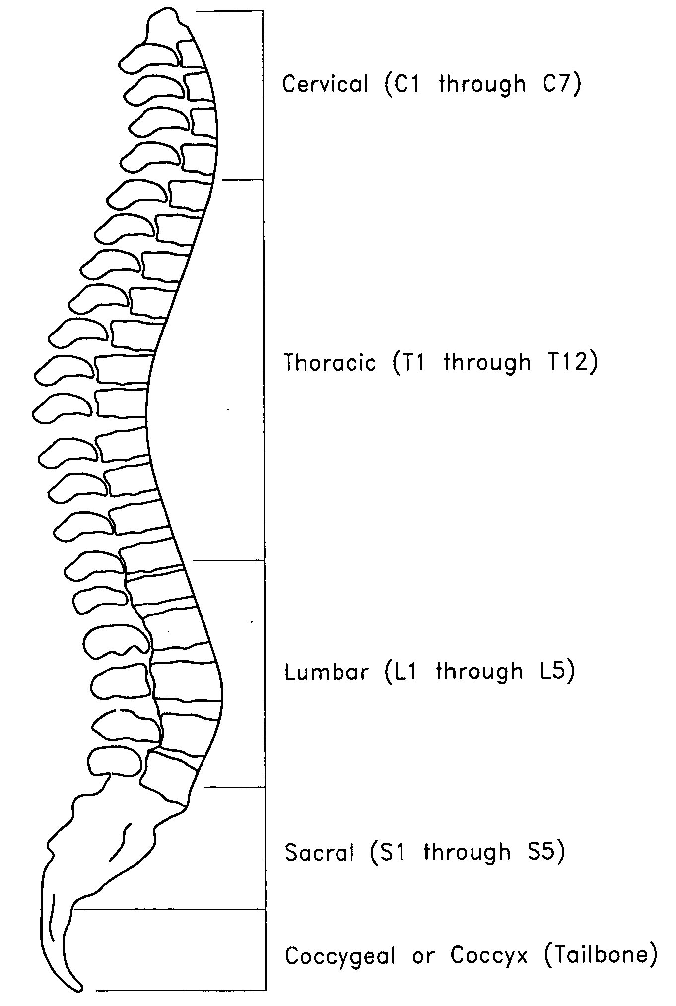 Access assembly for guiding instrumentation through soft tissue to a point on the spine