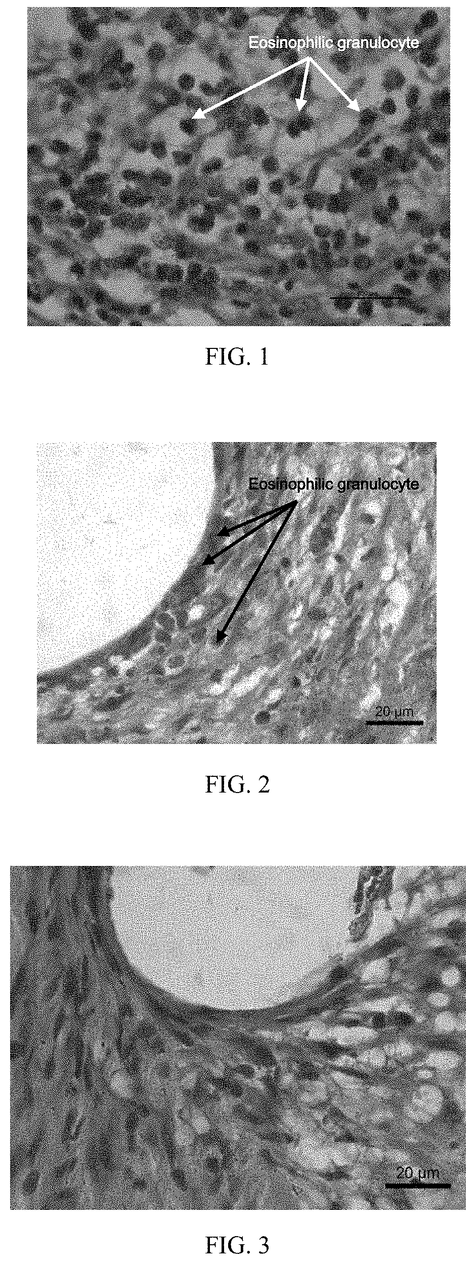 Implanted device