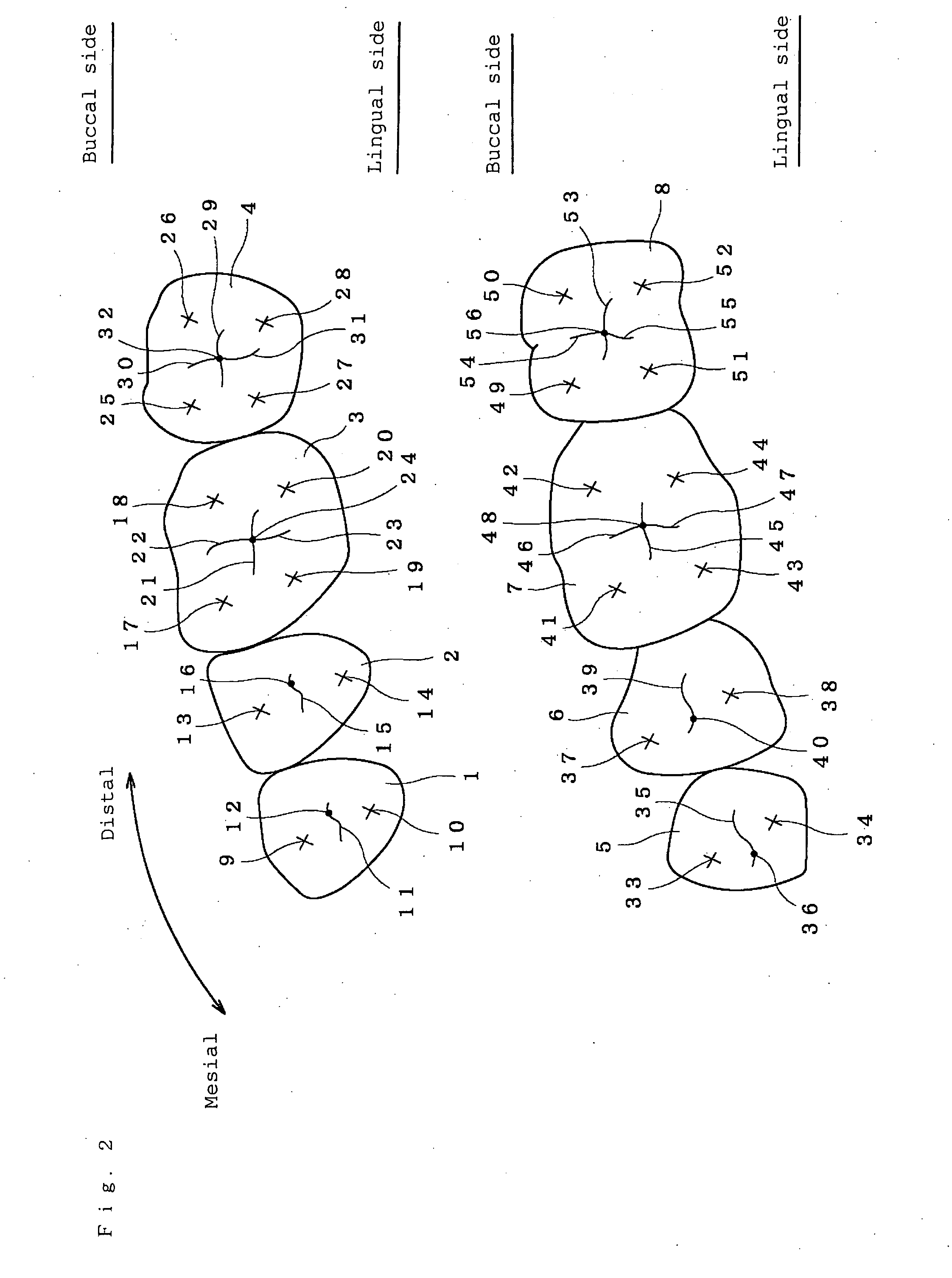 Artificial teeth