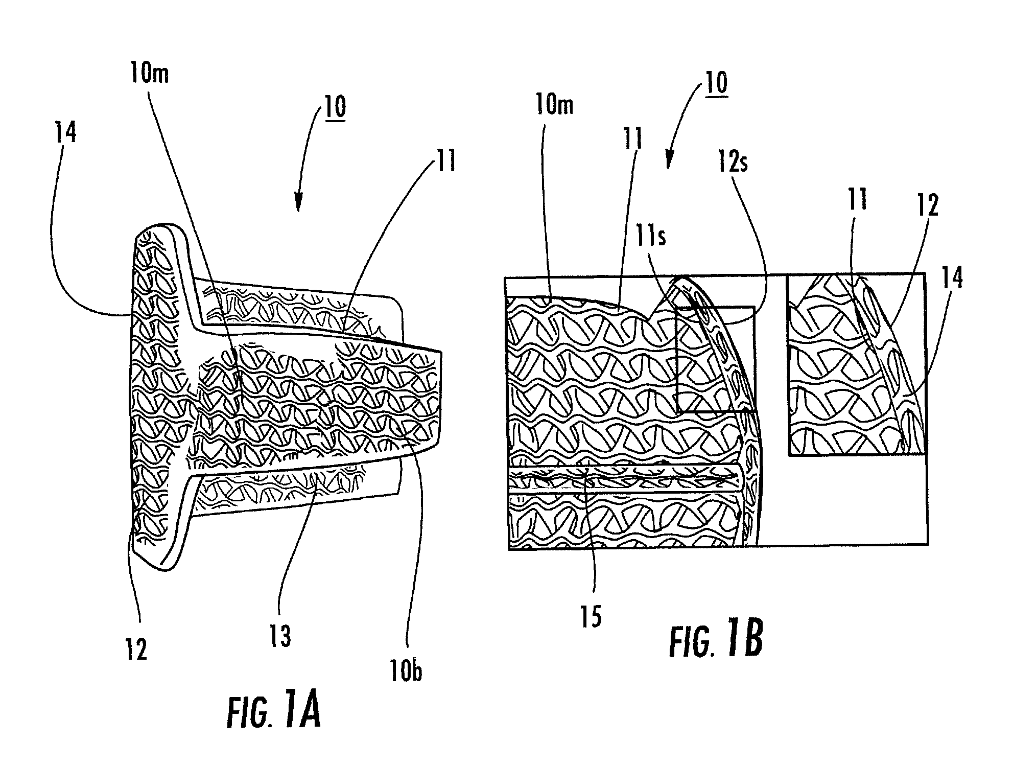 Methods and systems for forming implants with selectively exposed mesh for fixation and related implants