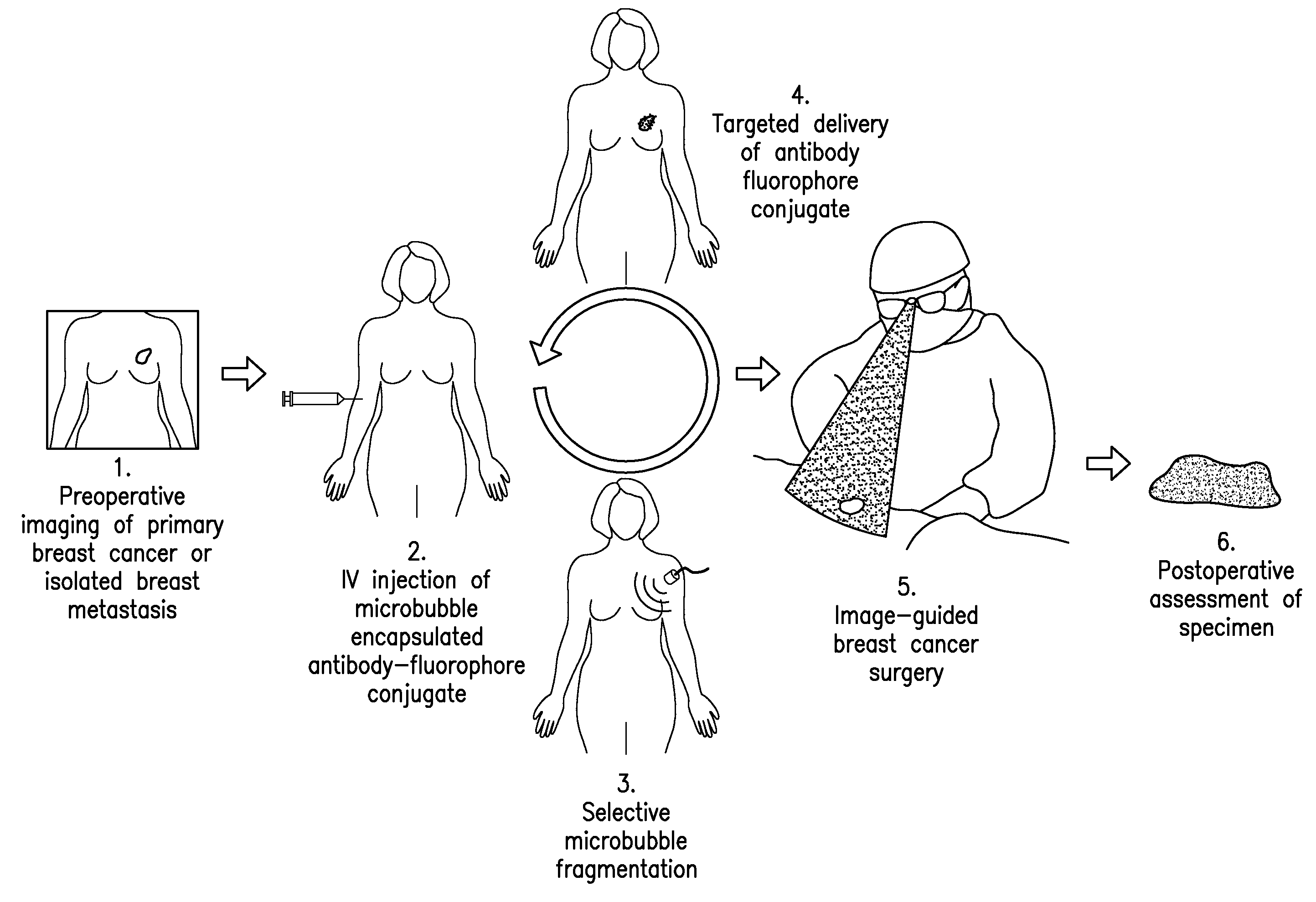 Fluorescence detection system