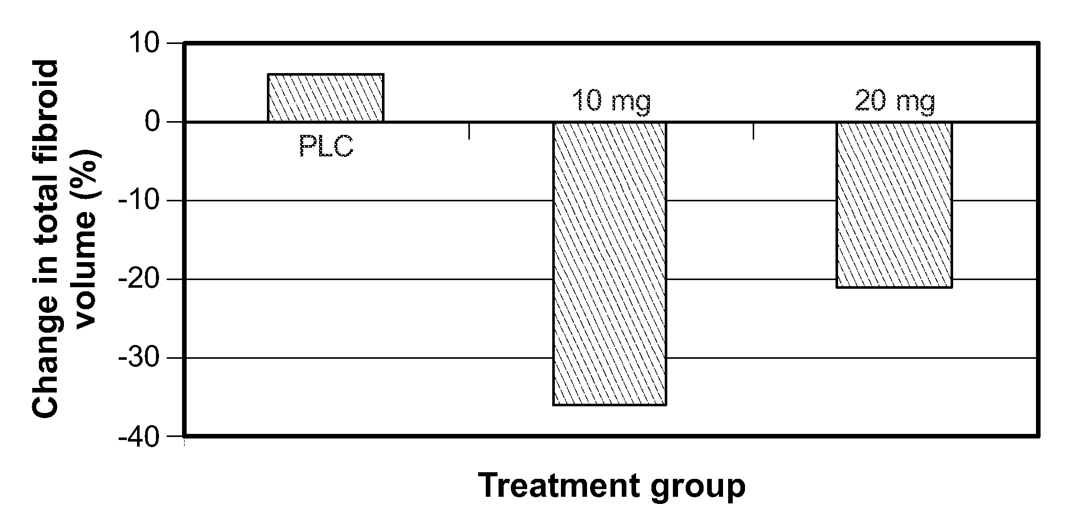 Method for Treating Uterine Fibroids