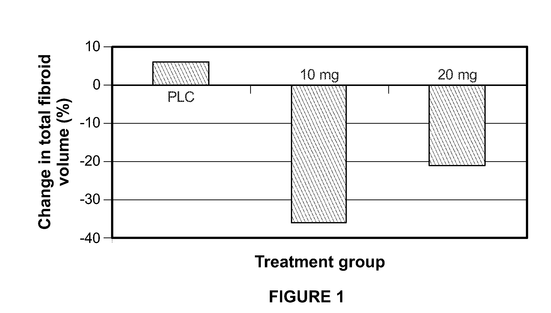 Method for Treating Uterine Fibroids