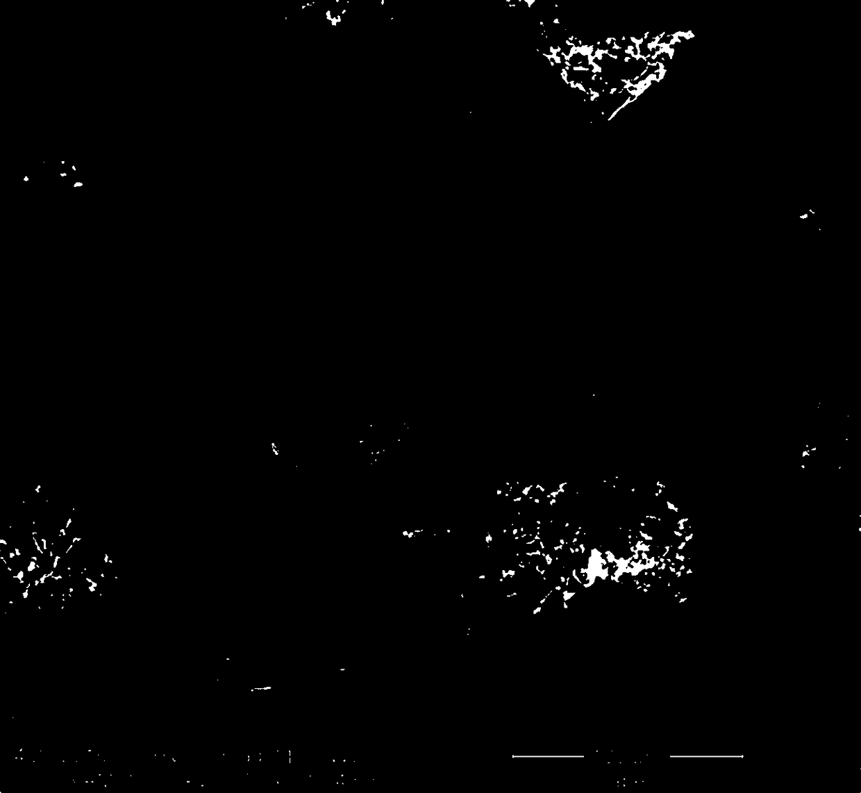 Preparation method of immobilized catalytic particle metal felt for producing biodiesel