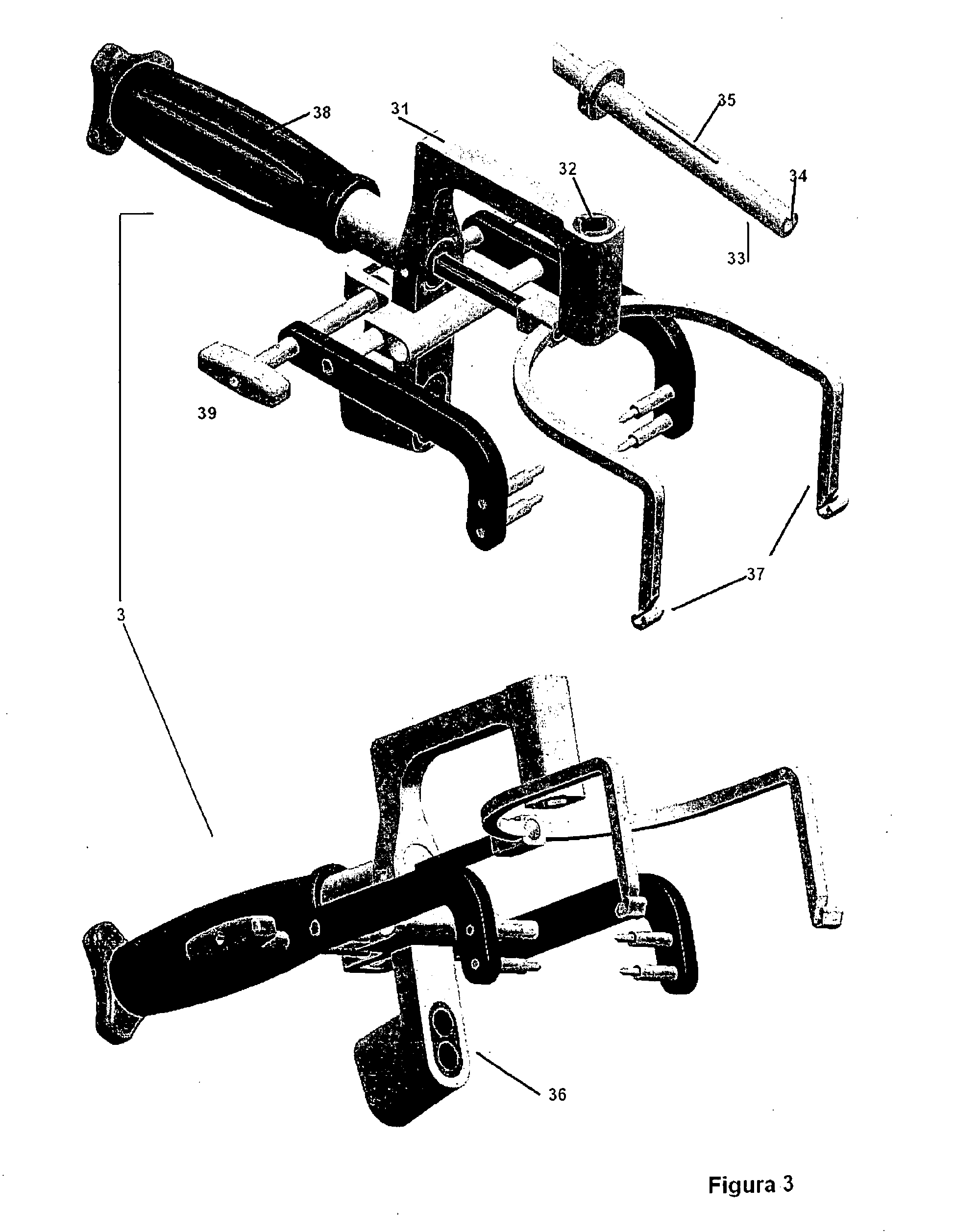 Locking nail system for arthrodesis reconstruction in calcaneus fractures