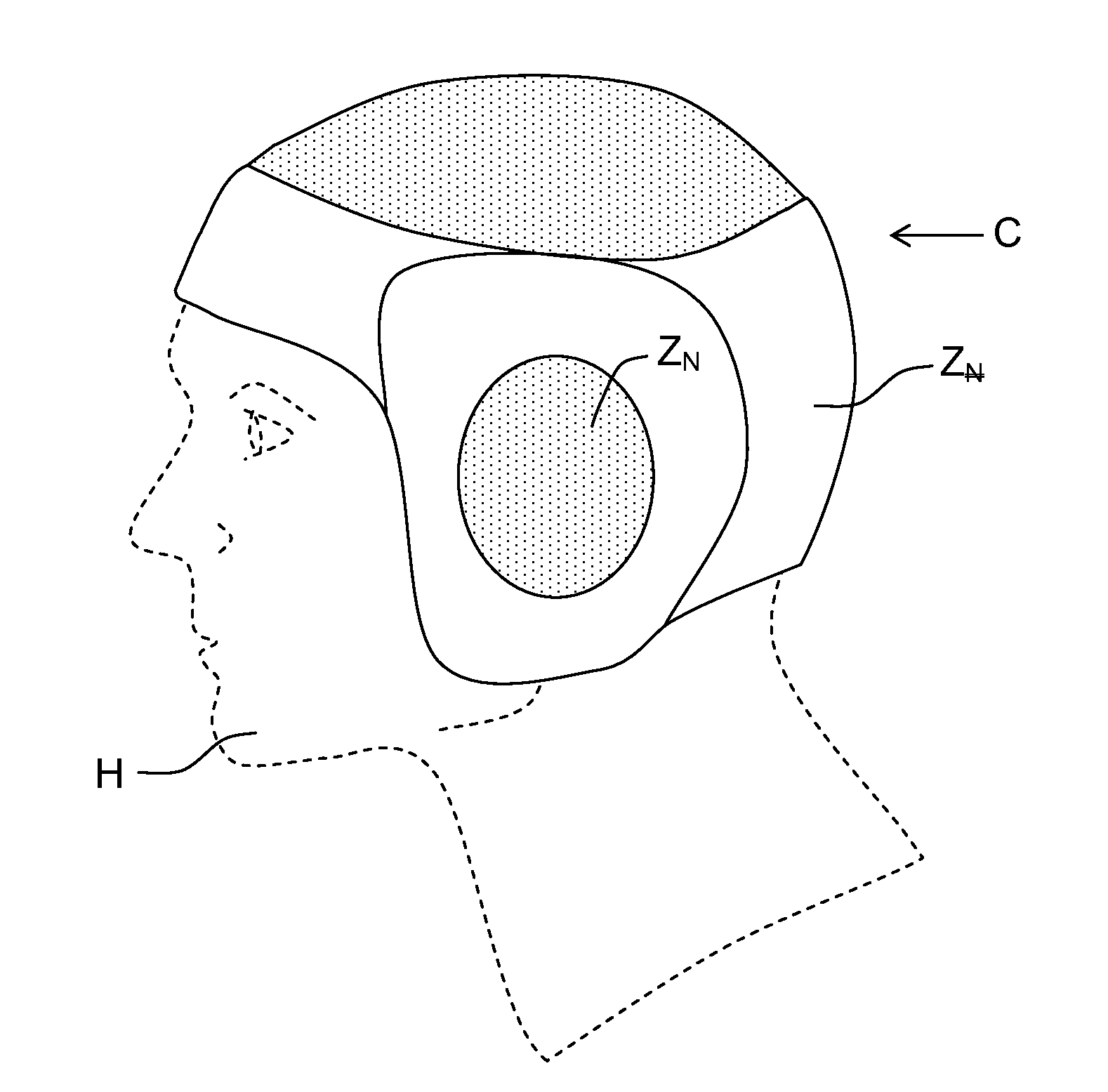 Helmet Shell Made of Composite Material