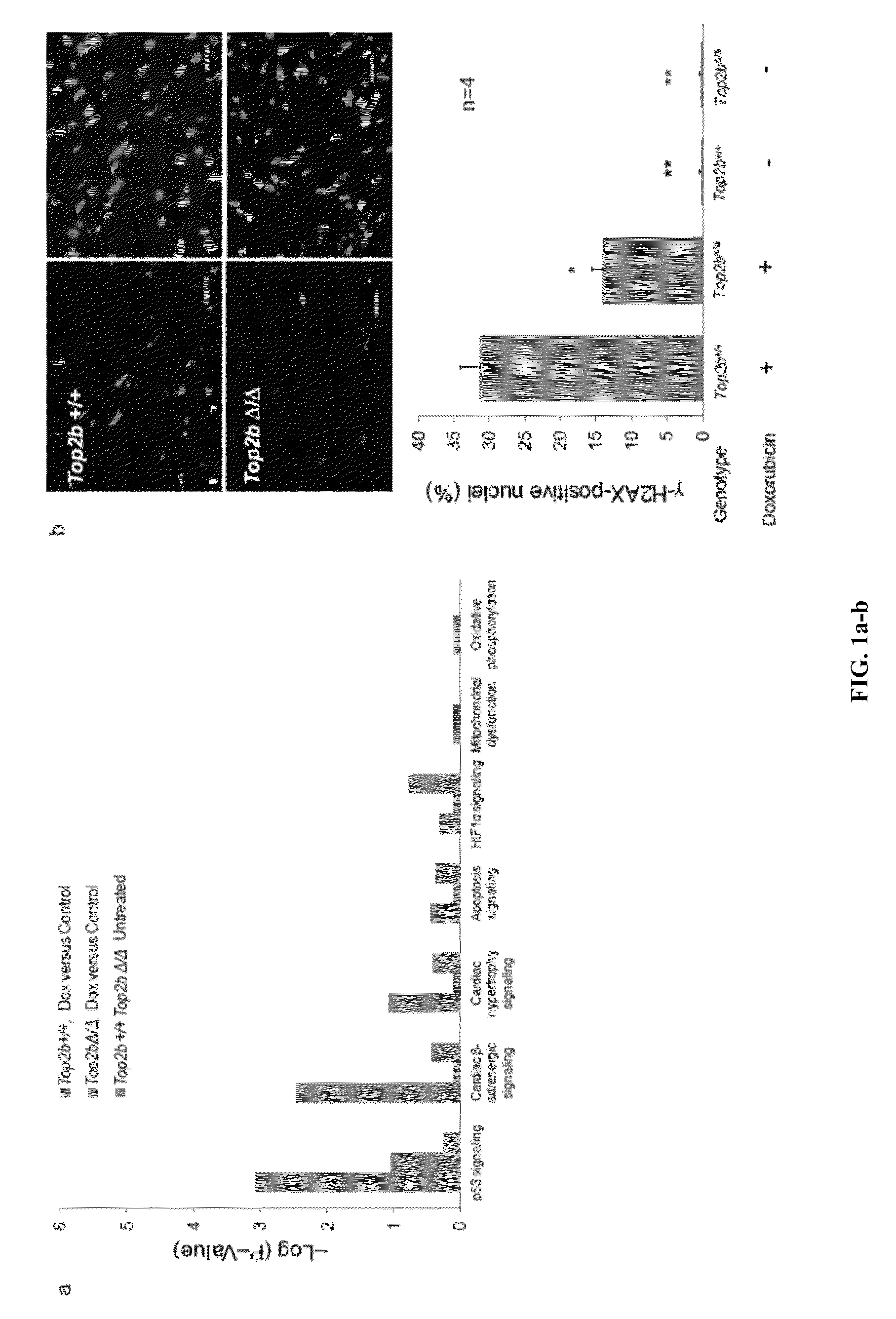 Topoisomerase 2b as a predictor of susceptibility to anthracycline-induced cardiotoxicity